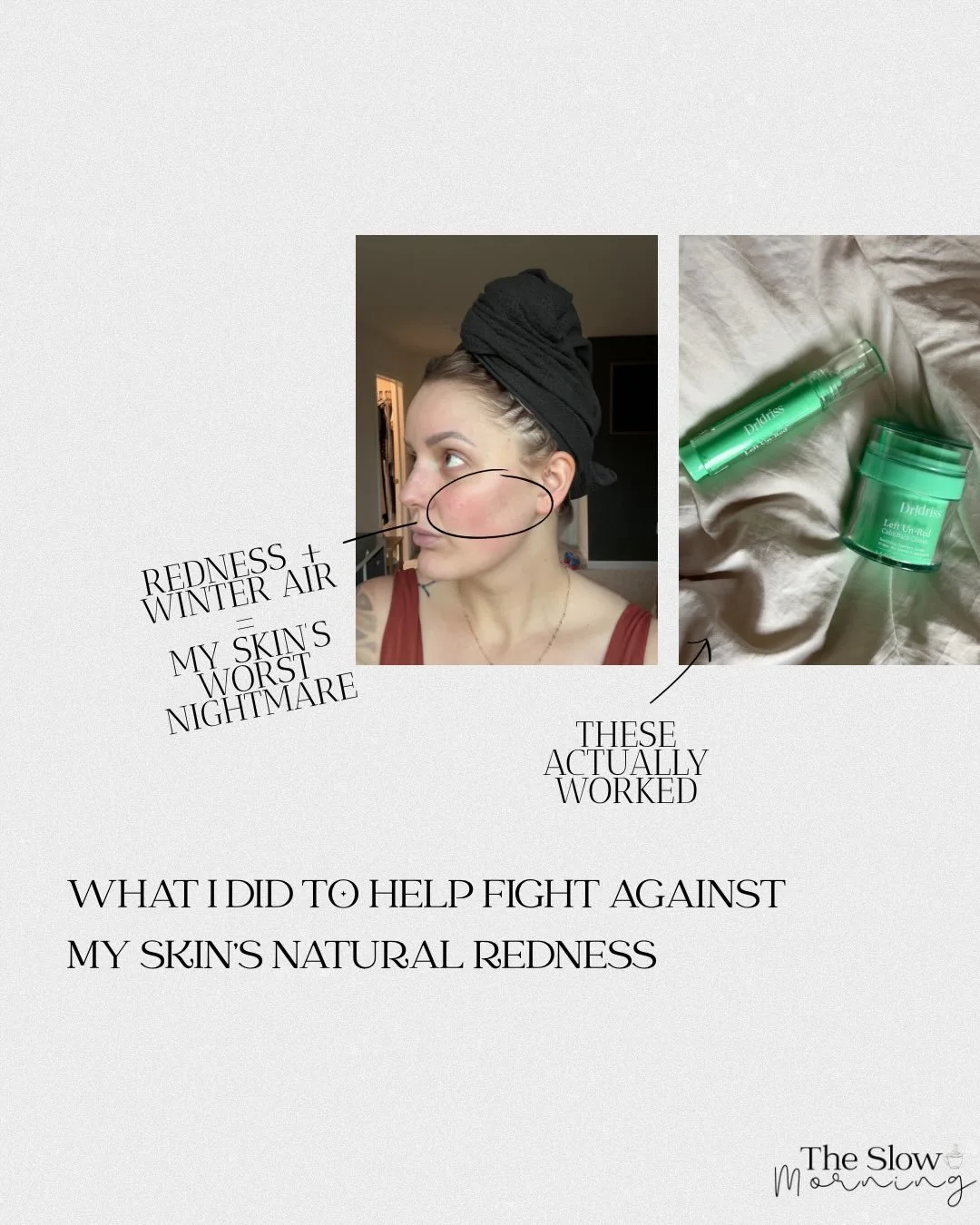 who else suffers from redness? the second there&rsquo;s a chill in the air, my skin flares up and no amount of foundation or skincare can help it&hellip;until now 👀

I recently started using @dr.idriss Left Un-Red duo and im actually seeing results 