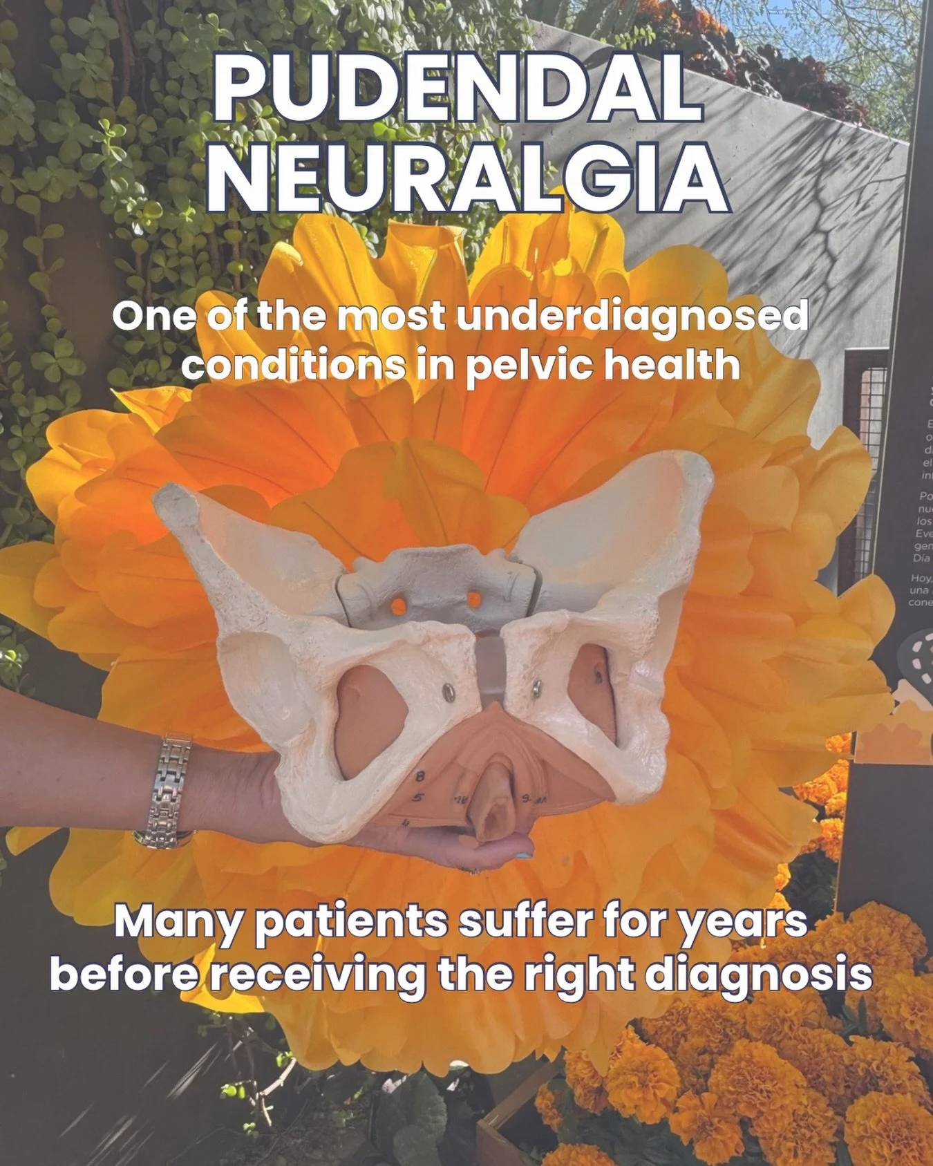One of the most underdiagnosed and misunderstood conditions in pelvic health

Many patients spend years searching for answers often seeing multiple providers before getting the right diagnosis ￼

This is exactly why expanding into pelvic care matters