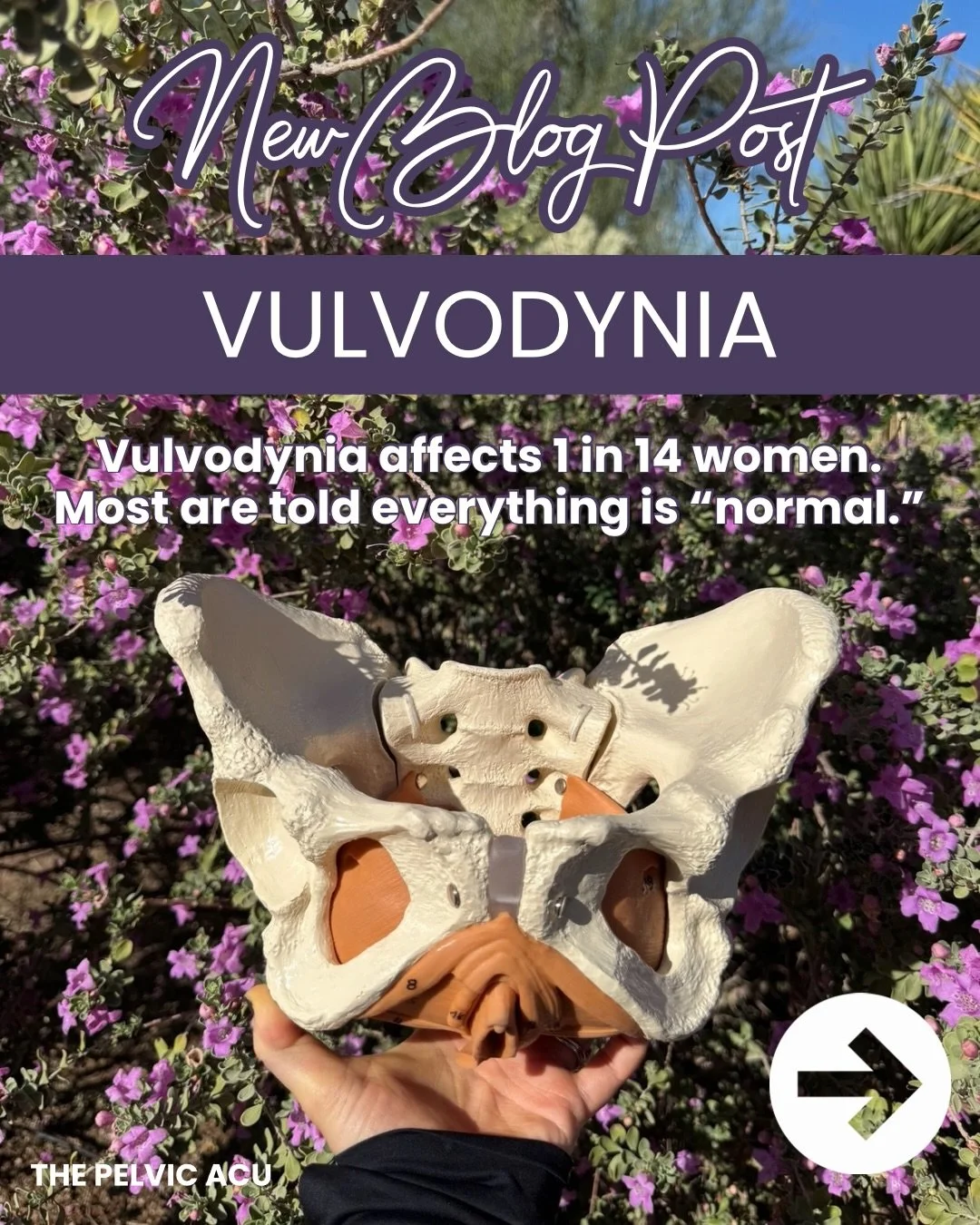 Vulvodynia is more common than most people realize.

And yet, so many patients are told everything looks normal while living with persistent, life altering pain.

When you start to look deeper at the nervous system, pelvic floor, and underlying patte