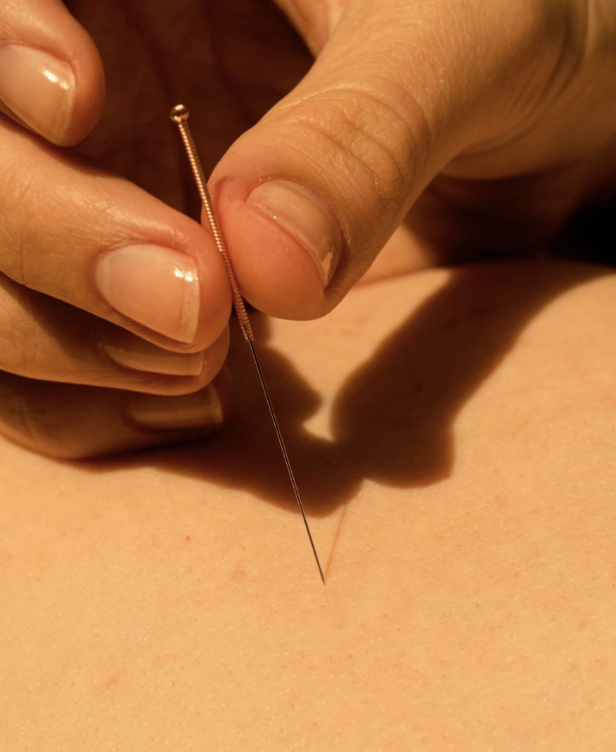 How Acupuncture Regulates the Nervous System and Boosts Wellness