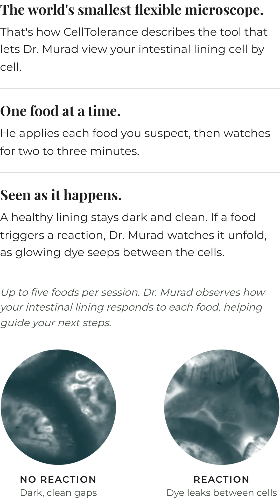 What Dr. Murad sees during CellTolerance testing: with no reaction, the intestinal lining shows dark, clean gaps; with a reaction, glowing dye leaks between the cells