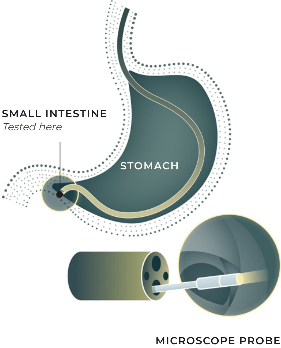 Illustration of the CellTolerance microscope probe passing through the stomach to view the small intestine lining
