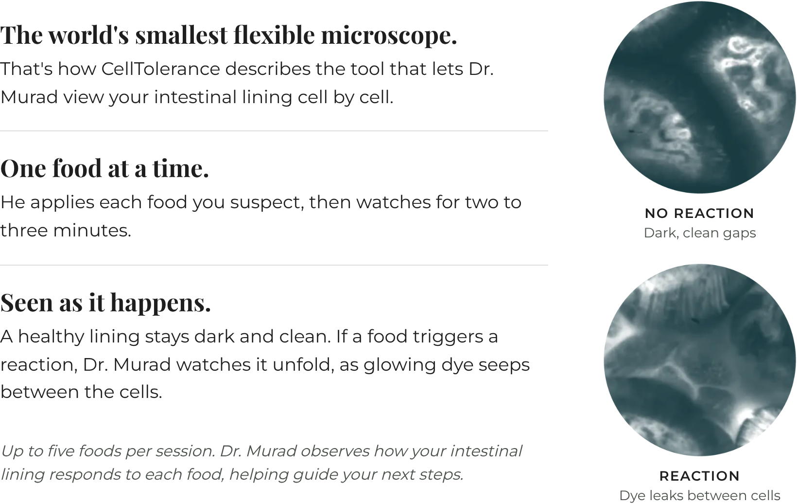 What Dr. Murad sees during CellTolerance testing: with no reaction, the intestinal lining shows dark, clean gaps; with a reaction, glowing dye leaks between the cells