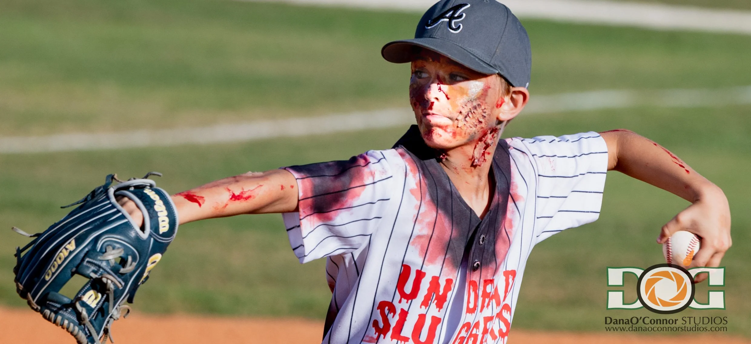 A young baseball player with a bloody face, wearing a striped jersey and a cap, throwing a baseball. The player's face and arm are bloodied, and they are on a baseball field.