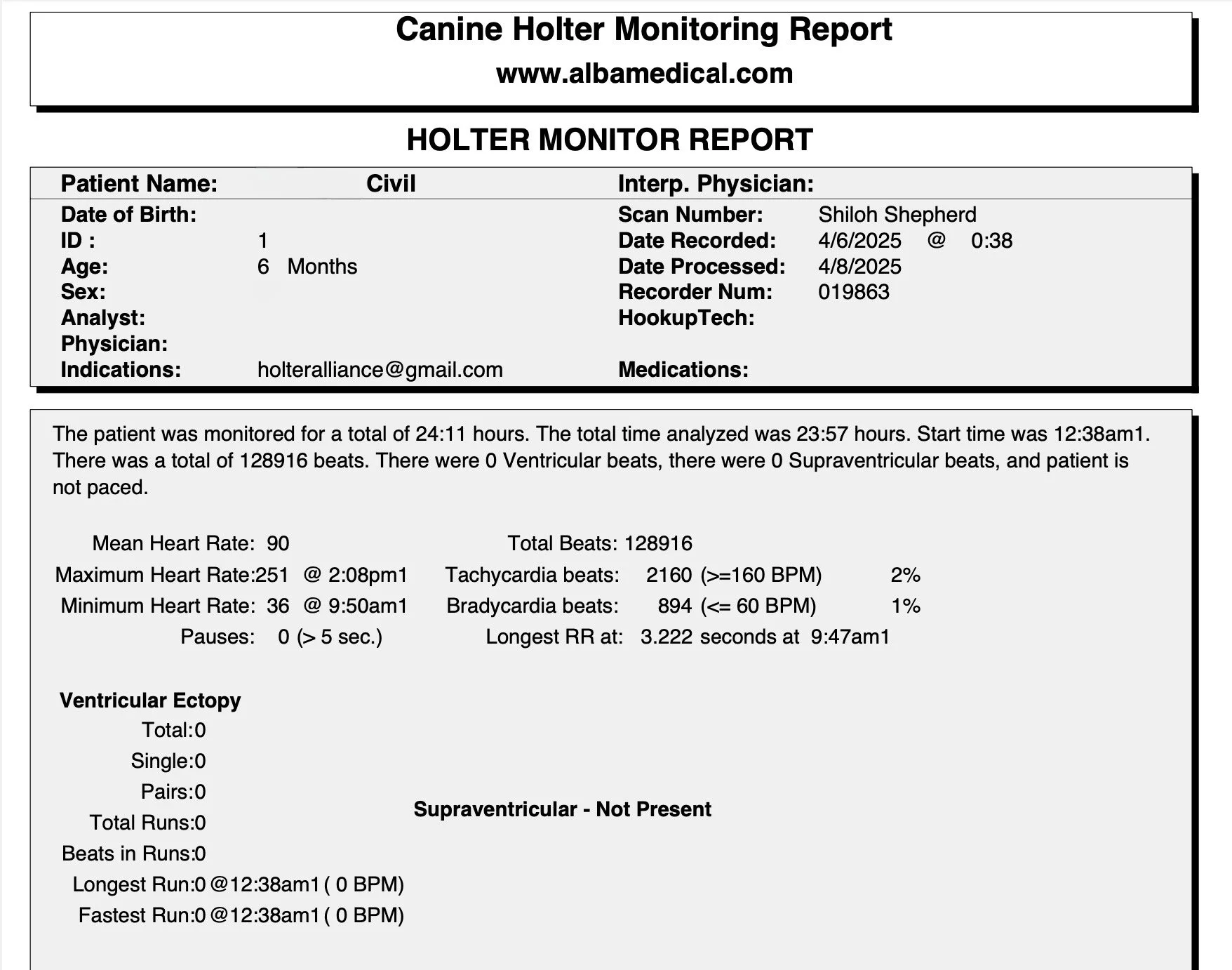 Holter Results