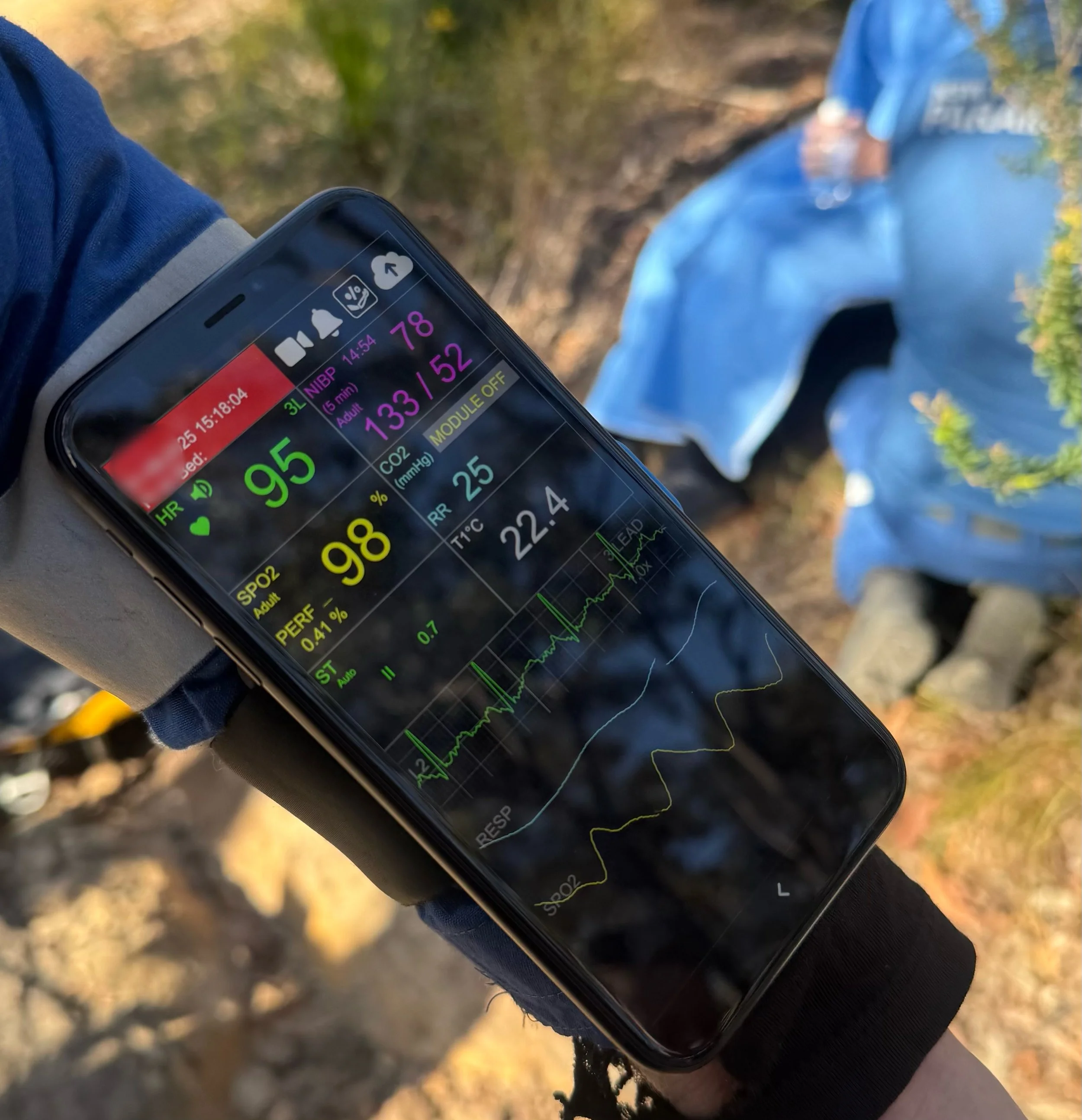 Recobro Wireless Monitoring