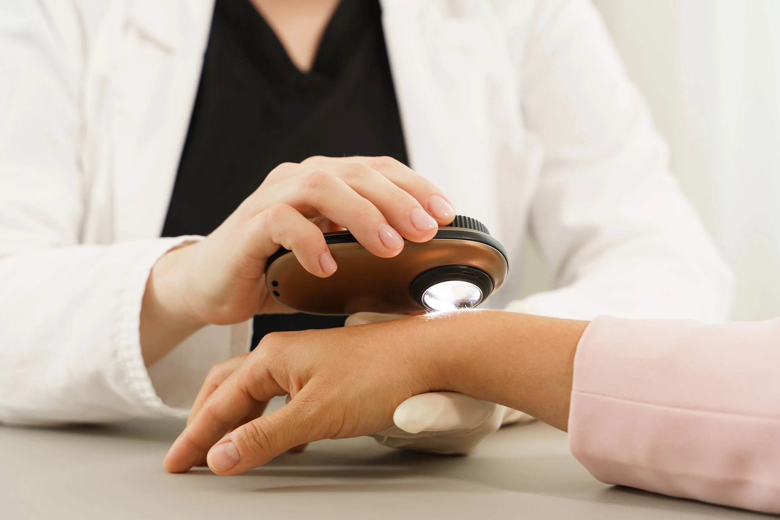 Medical professional examining a patient's arm with a handheld device emitting light during a skin assessment.