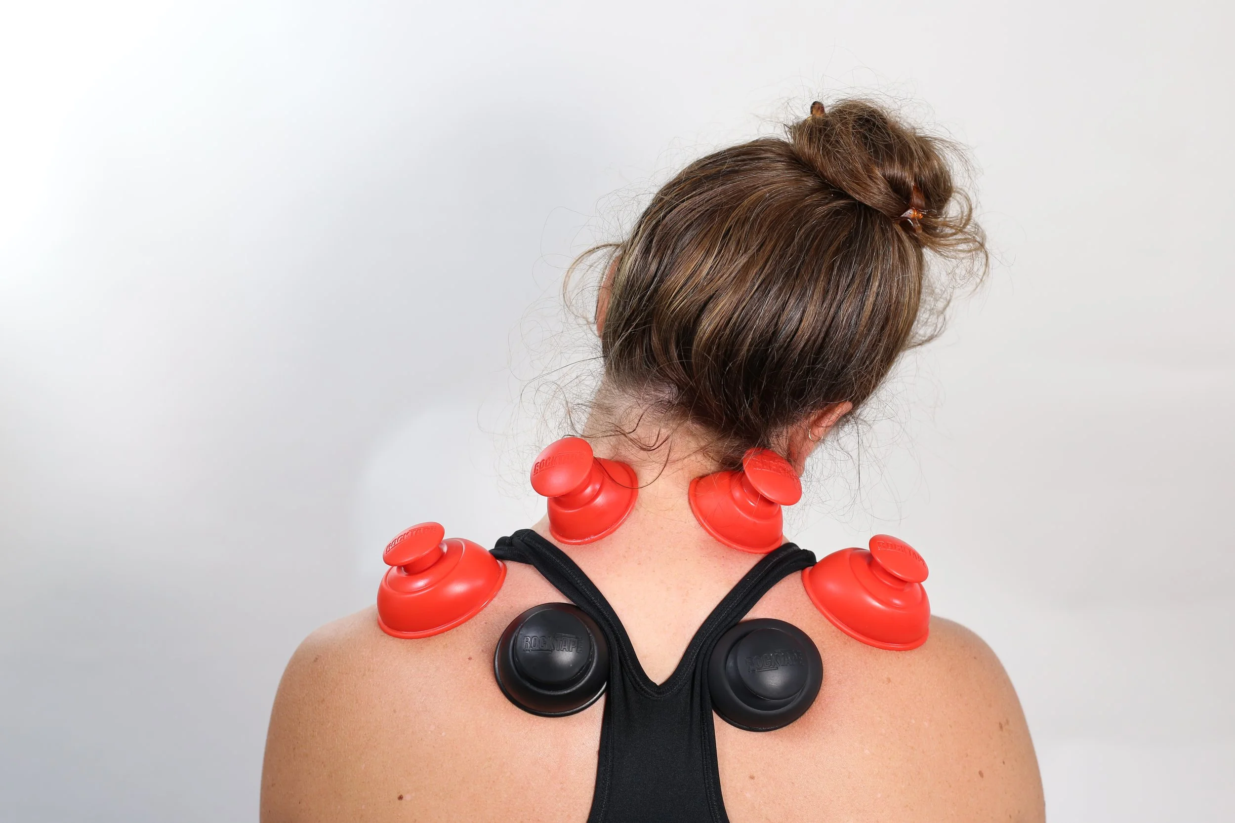 Cupping Therapy