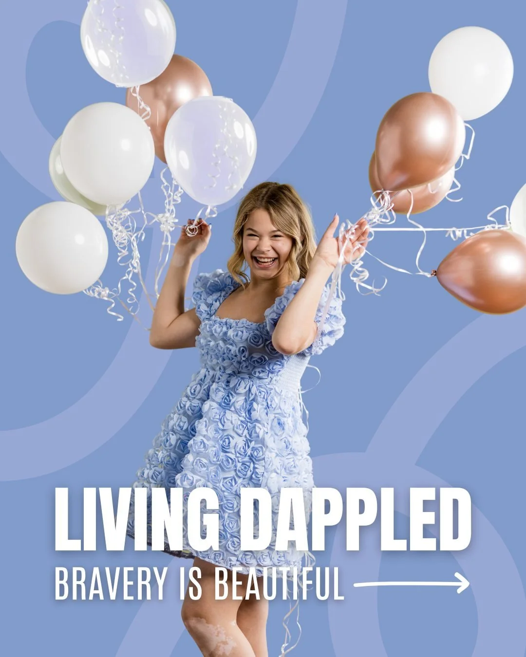 So excited to share that my vitiligo story is featured on @livingdappled, a space that highlights voices embracing the beauty and power of being different. 💫

This feature isn&rsquo;t just about telling my story. It&rsquo;s a reminder to everyone th