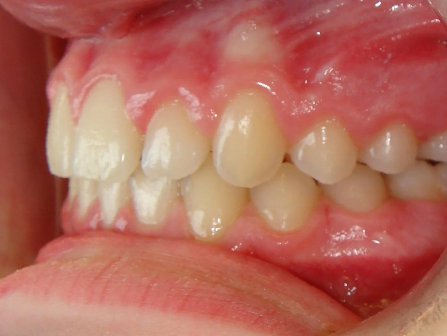 Close-up side view of human teeth and gums showing ideal alignment and occlusion.