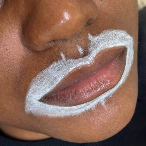 Zoom sur des lèvres avec un cercle blanc tracé autour, ainsi qu'une autre ligne blanche au-dessus de la moustache, probablement pour un maquillage ou un soin.