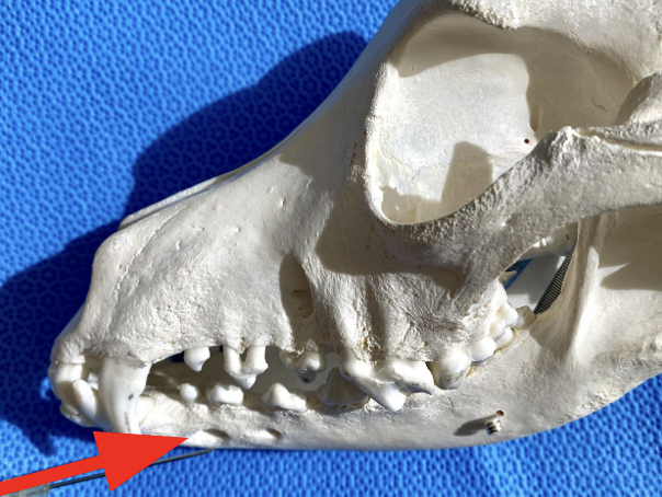 Figure 9B. Arrow indicates the mental foramen.
