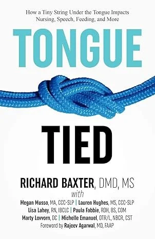 Book cover titled 'How a Tiny String Under the Tongue Impacts Nursing, Speech, Feeding, and More: Tongue Tied' with an illustration of a blue knotted rope.