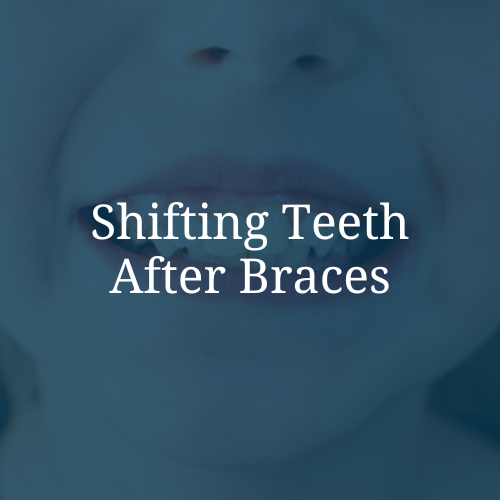 Close-up of a person's open mouth showing teeth, with text overlay saying 'Shifting Teeth After Braces'.