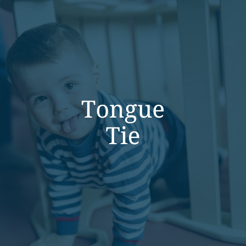 A young boy with short hair making a face with his tongue out, wearing a striped shirt, next to a white railing, with the text "Tongue Tie" overlaid.
