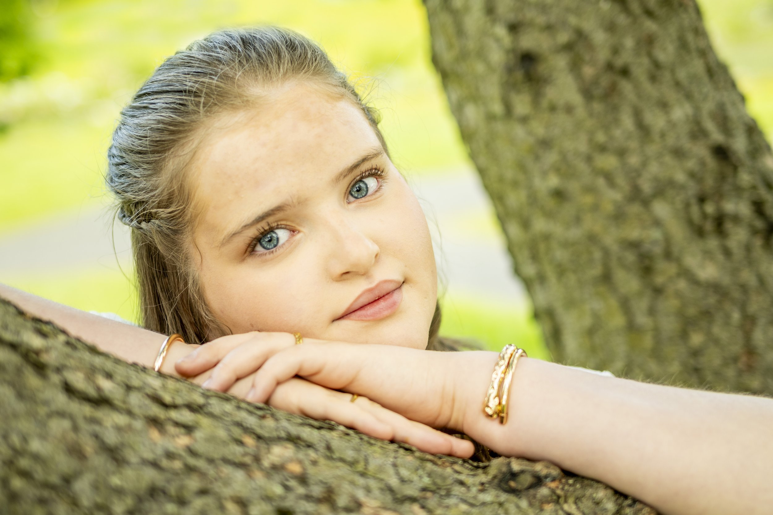 A young woman with blue eyes and light brown hair resting her head on her arms on a tree branch outdoors, with a blurred green background.