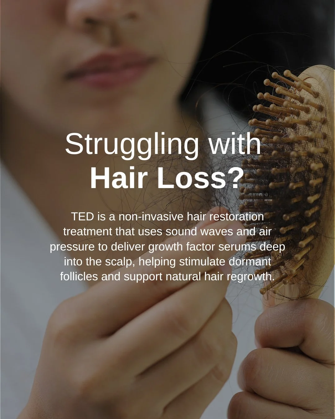 Struggling with hair thinning or hair loss? TED Hair Restoration is a needle-free, non-invasive treatment that uses sound waves and air pressure to deliver growth factors deep into the scalp, supporting natural hair regrowth with no downtime. ✨️⁠
⁠
B