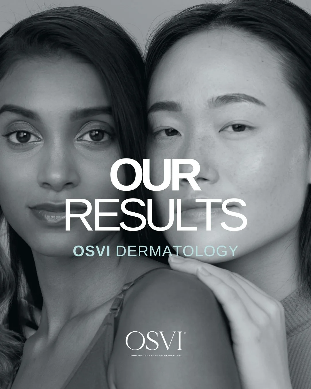 At OSVI, every before &amp; after tells a story of personalized care, thoughtful planning, and results that are as unique as our patients.⁠
⁠
Swipe, compare, and see why who you choose matters.