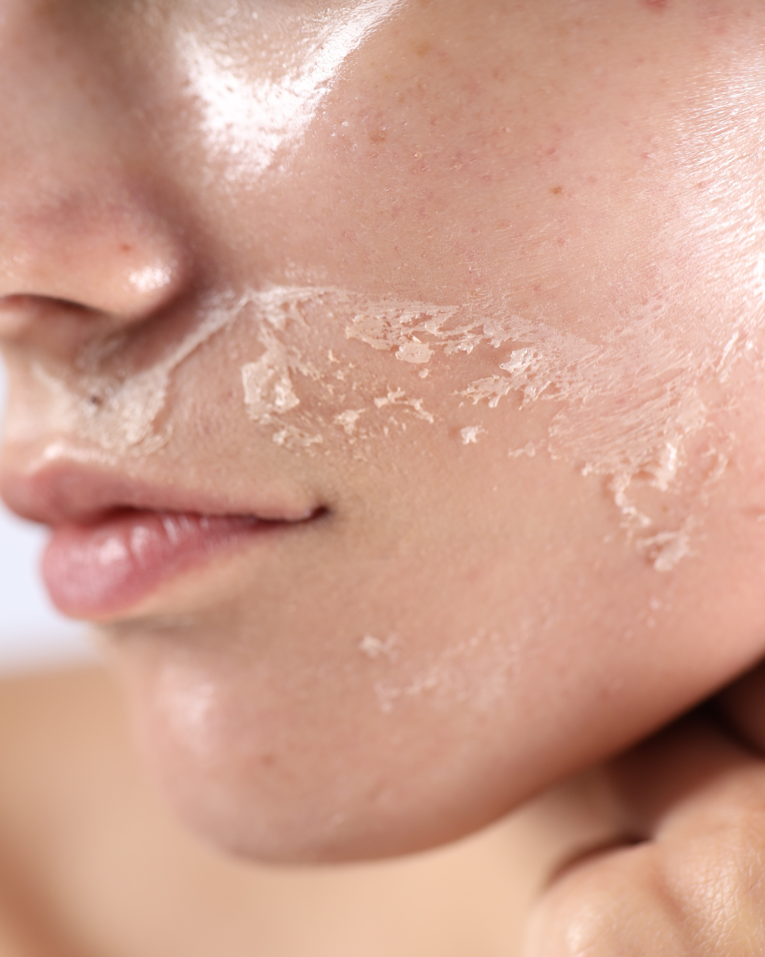 Spring Skin Reset: Why April Is the Best Time to Refresh Your Skin