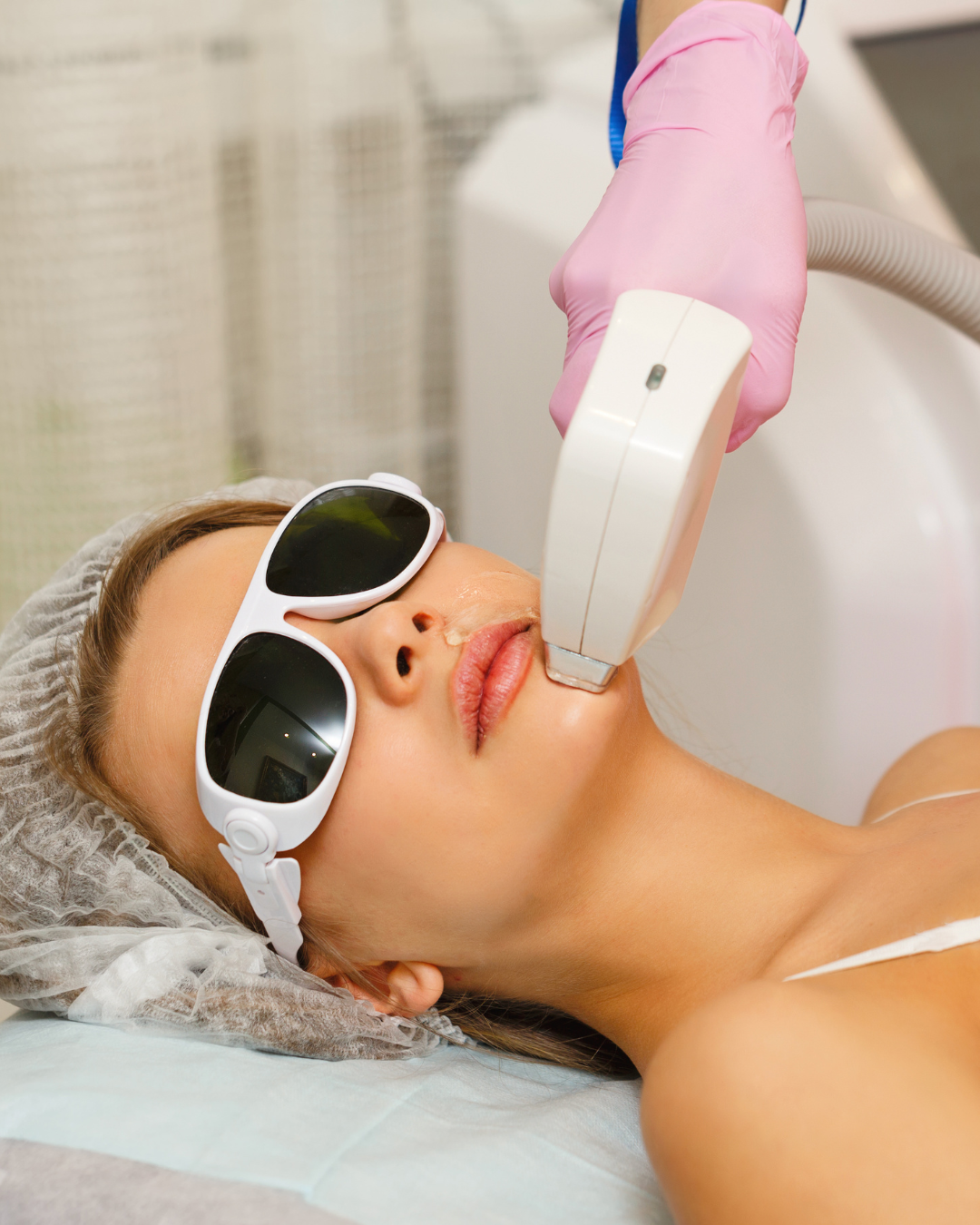 IPL Laser: What It Really Does for Sun Damage