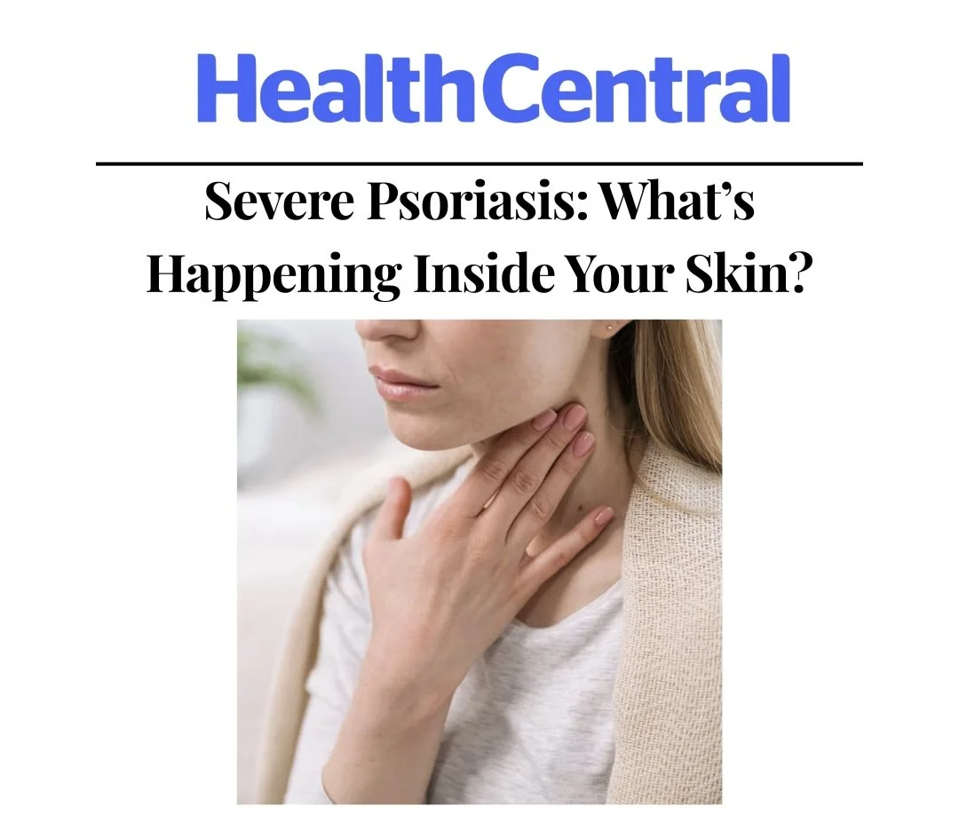 Severe Psoriasis: What's Happening Inside Your Skin?