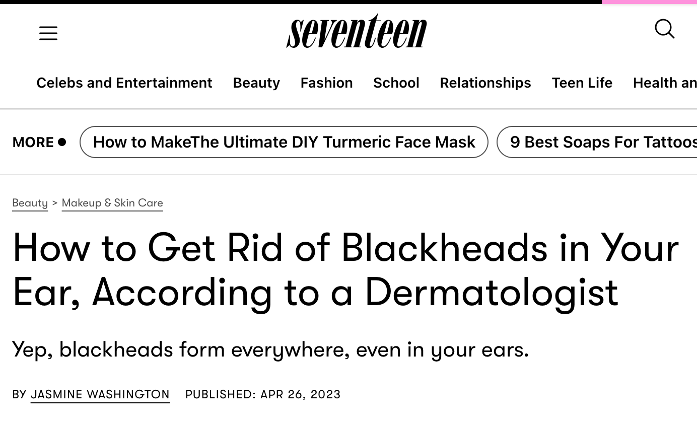 How to Get Rid of Blackheads in Your Ear, According to a Dermatologist