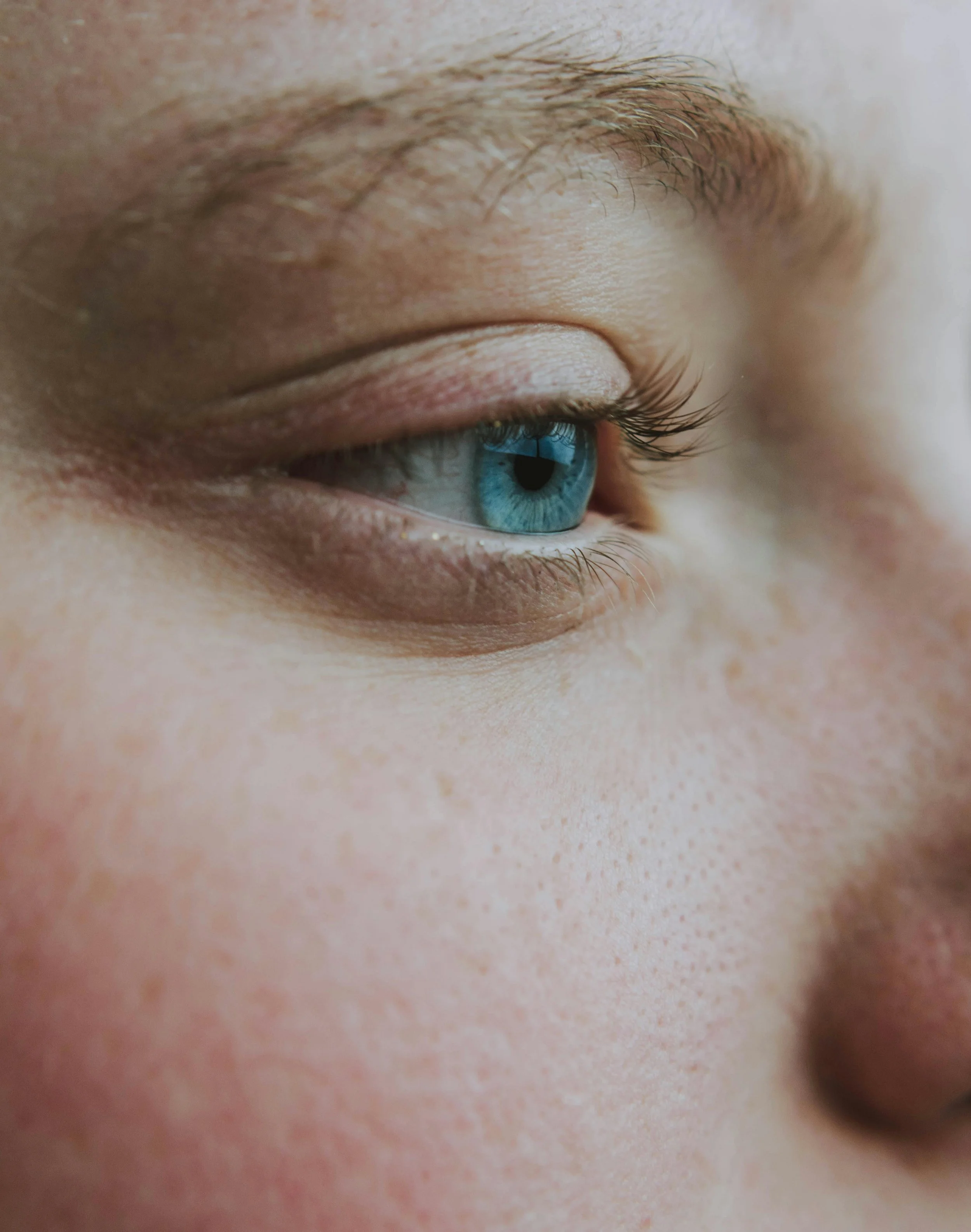 How Cold Weather Triggers Rosacea – And How to Keep Redness Under Control