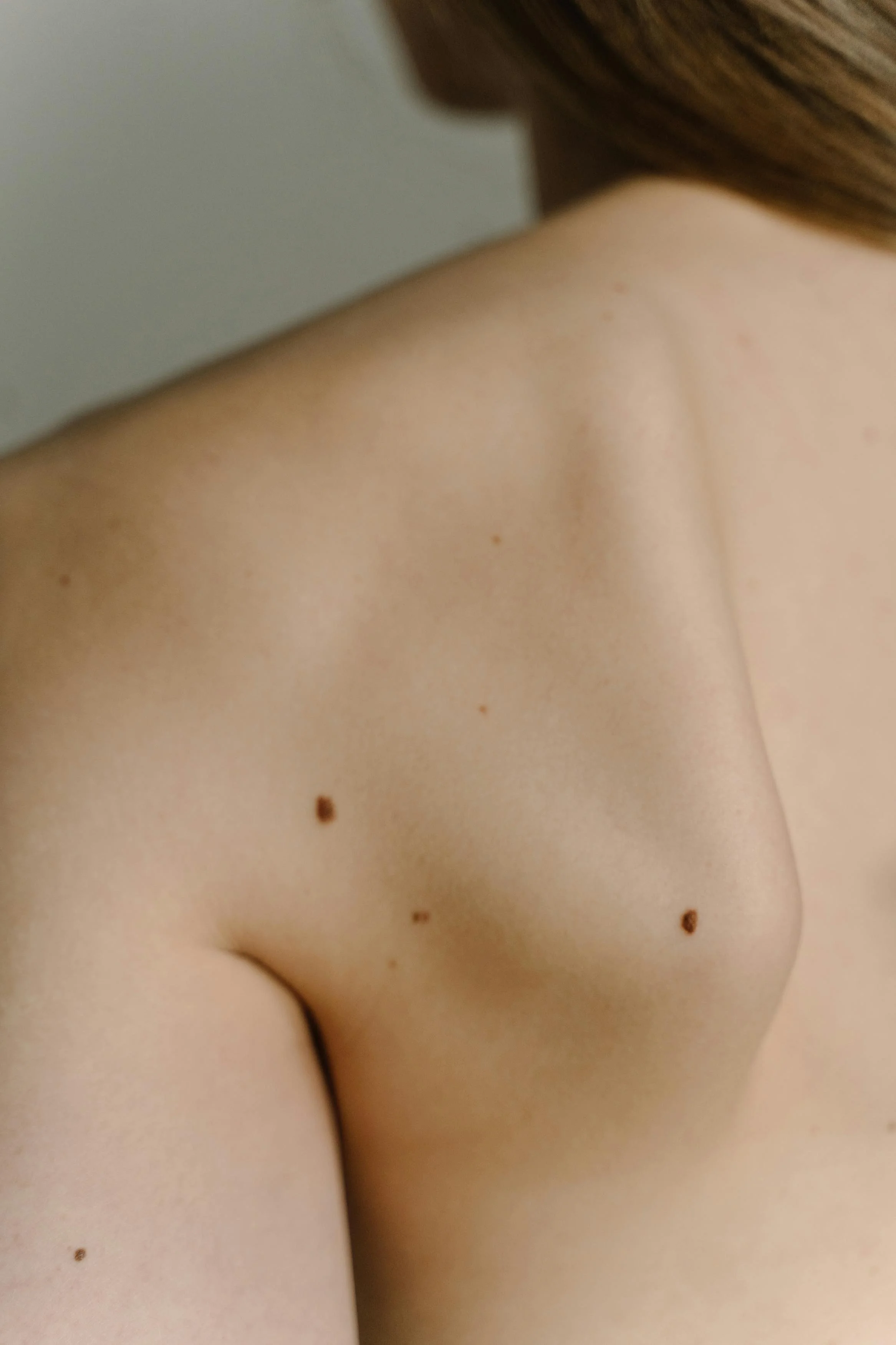 Why Skin Cancer Checks Matter Even in Winter