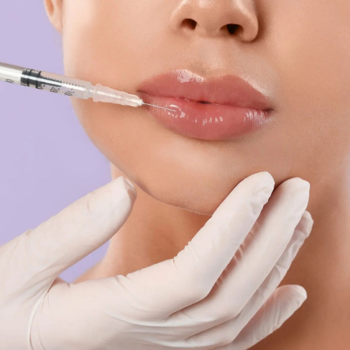 Lip Filler Myths Debunked by Dermatologists