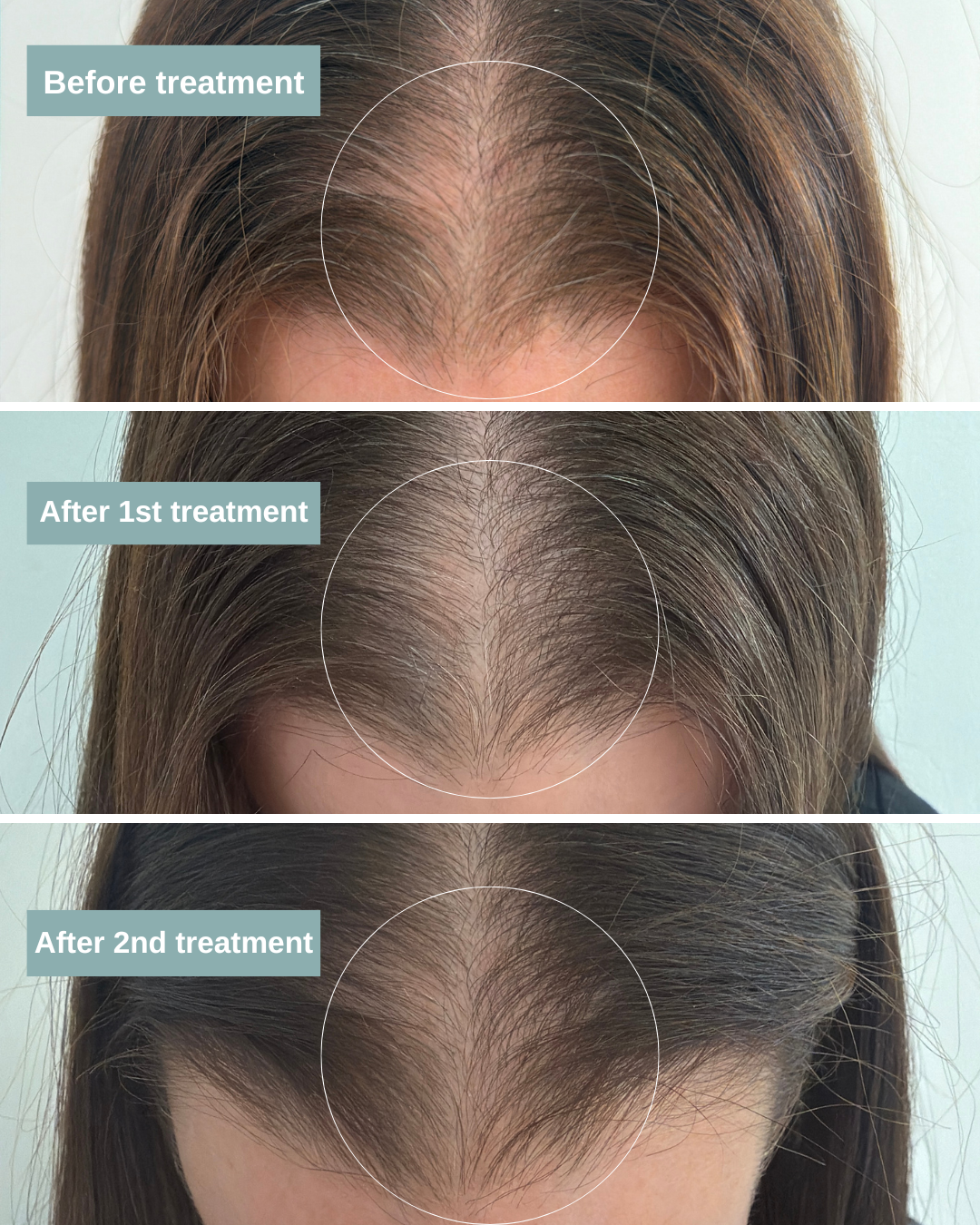 Man hair before and after TED Hair Treatment