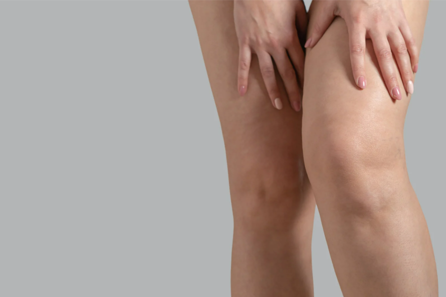 Non-surgical cellulite reduction treatment to improve smoother-looking skin.