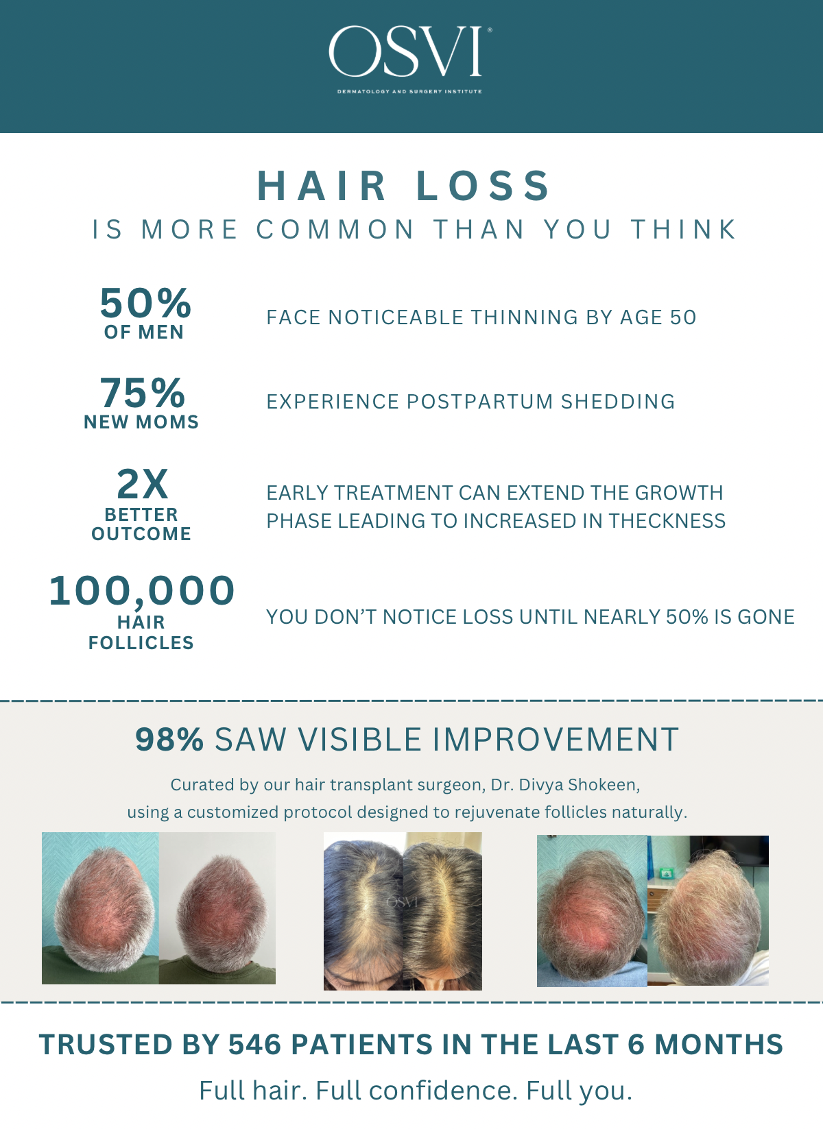 OSVI Signature Hair Growth Treatment - With Photos