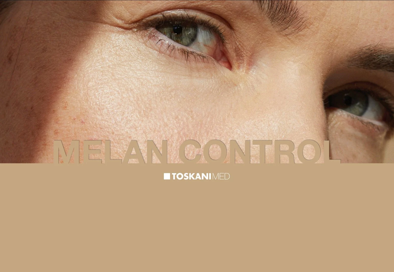 Toskani pigmentation correction treatment in Brickell Miami