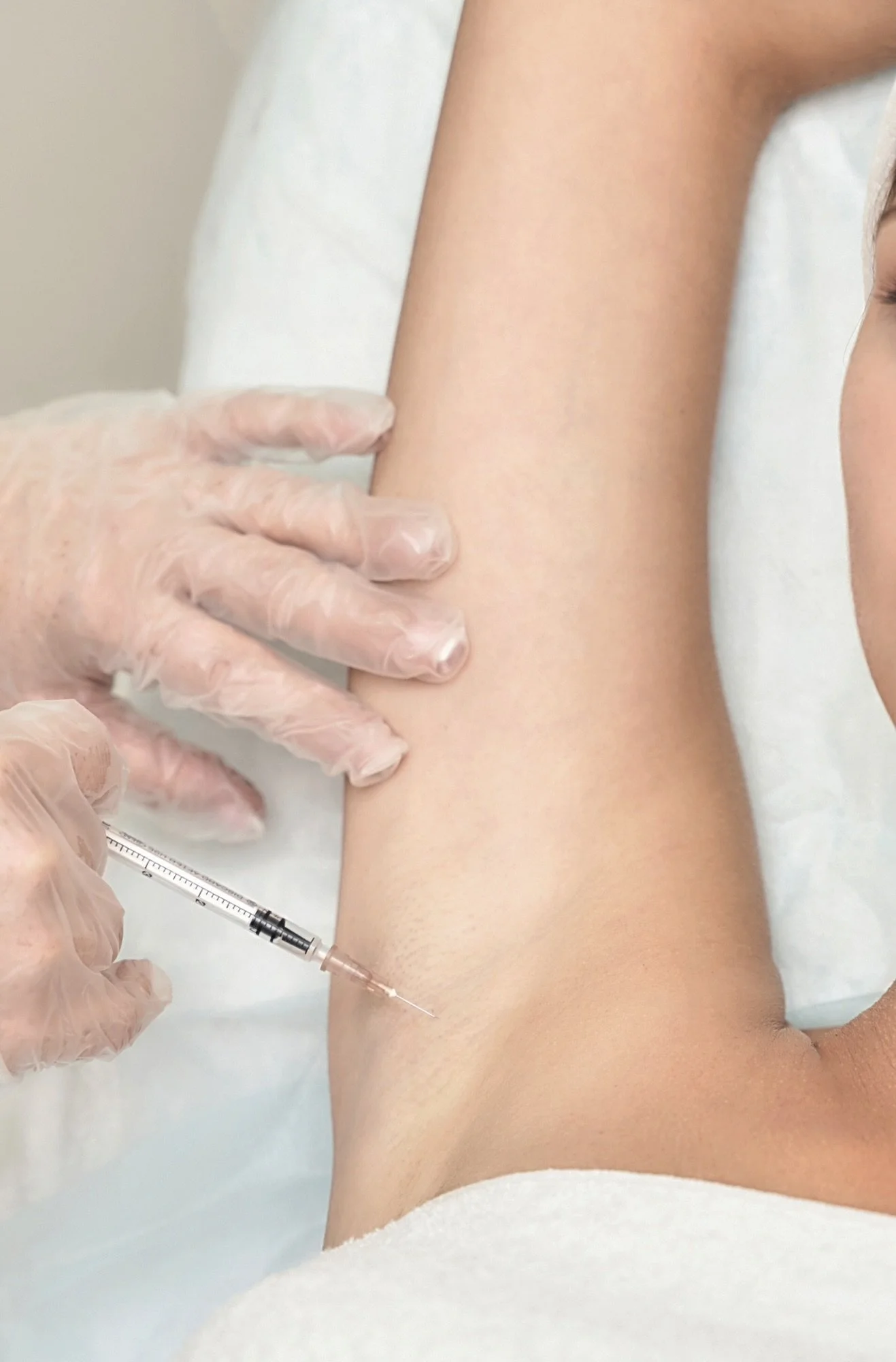 Trap Tox, armpit sweating, hyperhidrosis, and microbotox treatments in Brickell Miami clinic