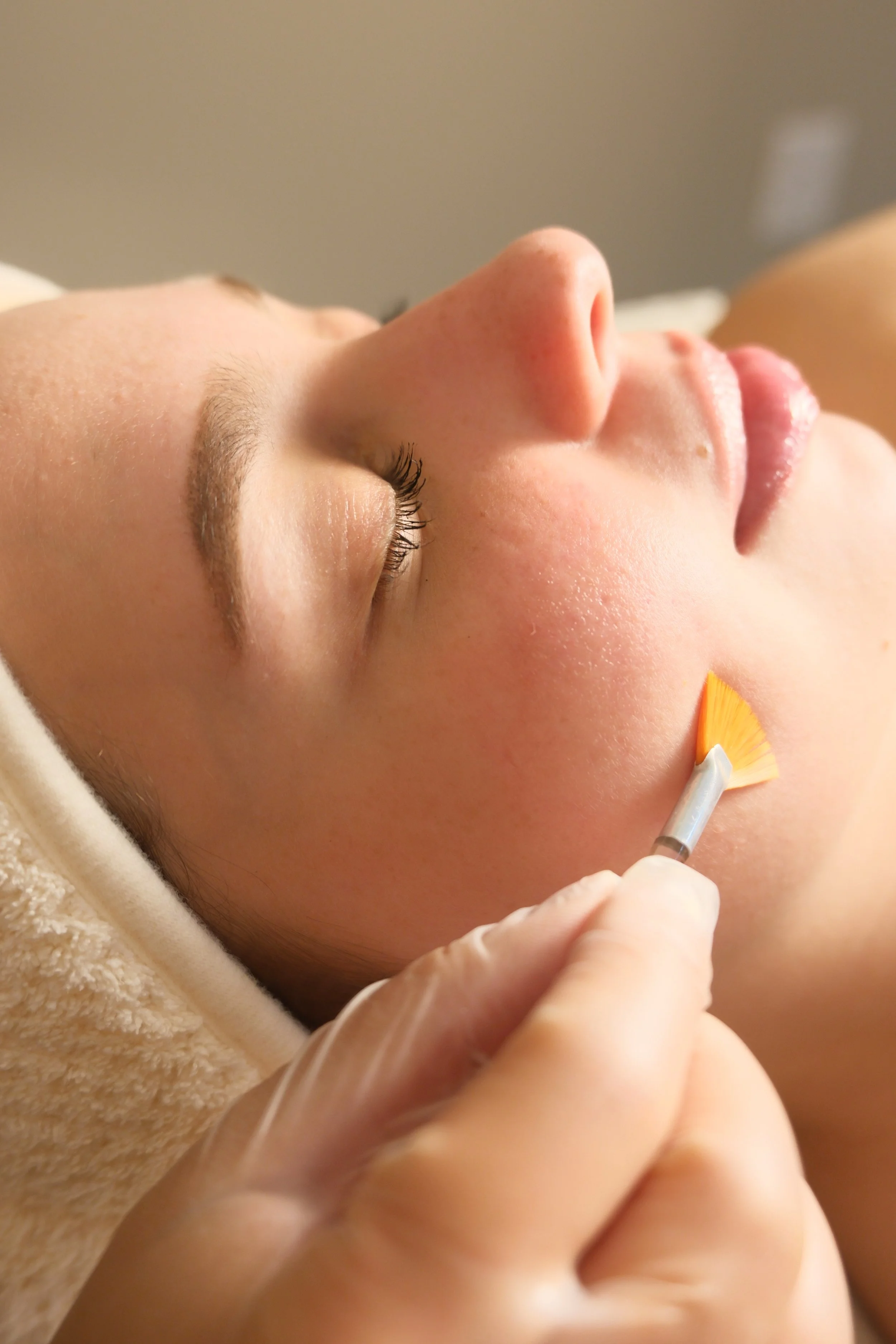 Professional triple acid glow peel for luminous skin in Brickell Miami