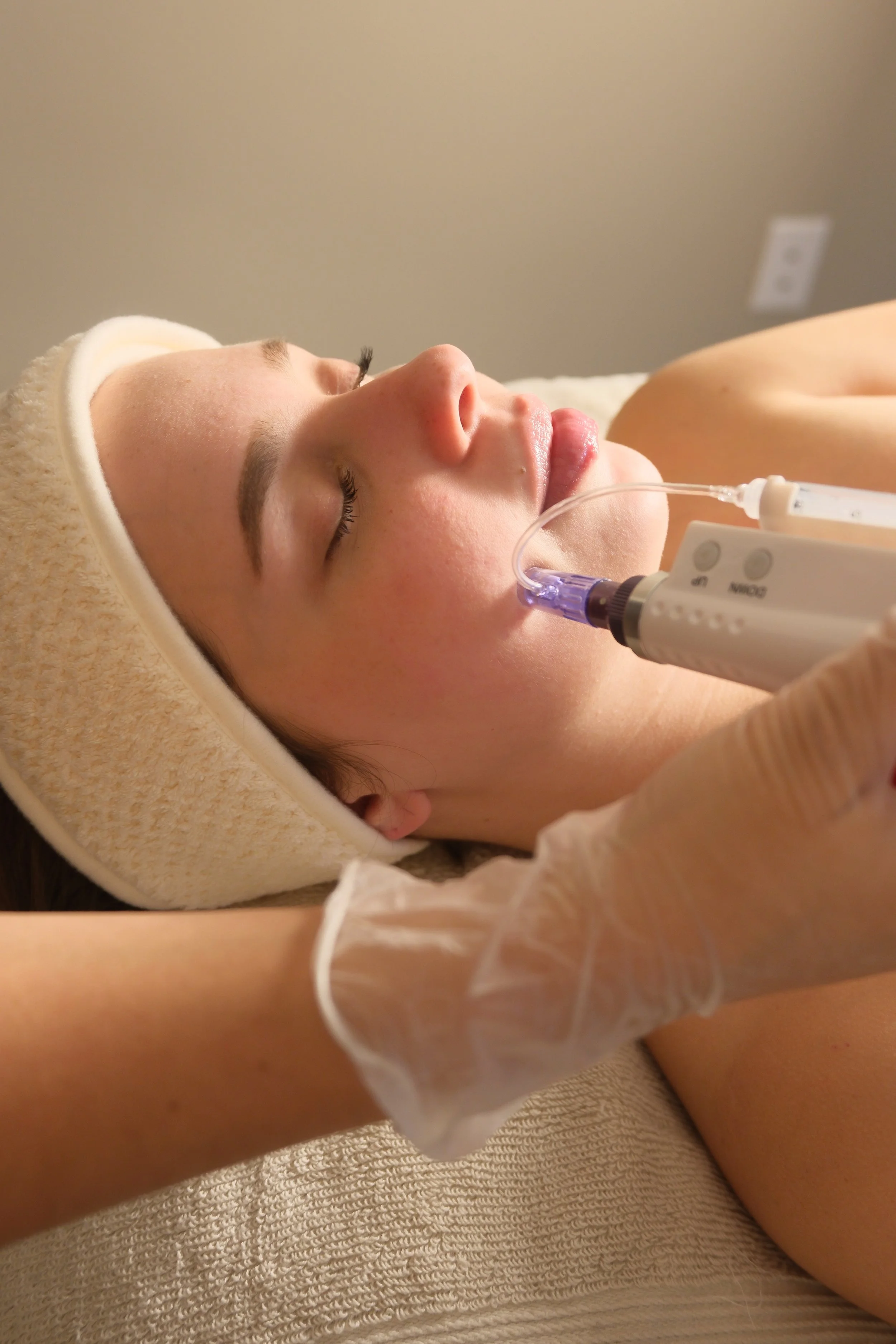 Exosome microneedling regenerative skin therapy in Brickell Miami