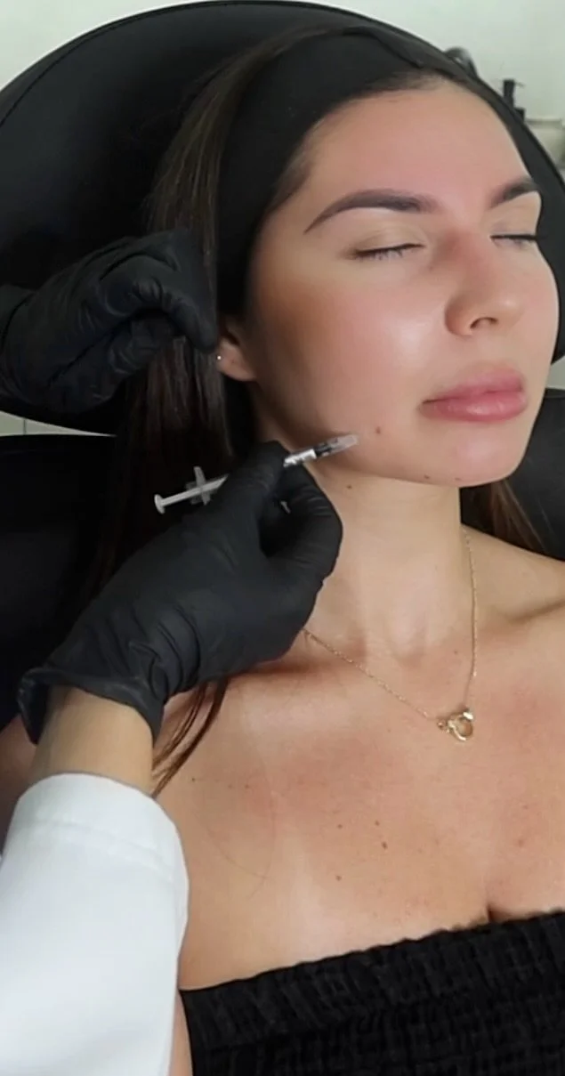 Gummy smile smoker lines and lip flip Botox for subtle enhancement in Miami aesthetics