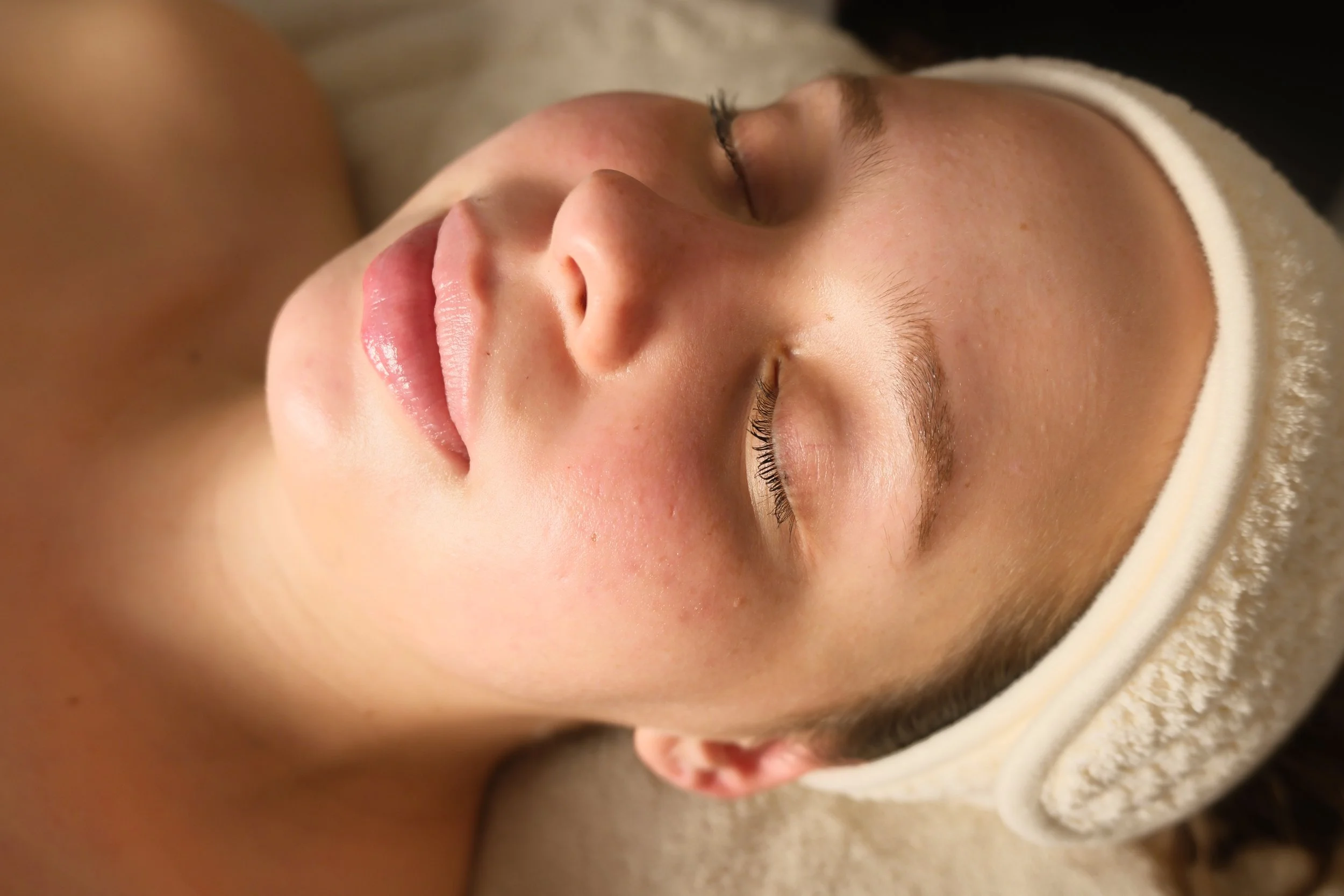 Lip hydration microneedling for smooth plump lips in Brickell Miami