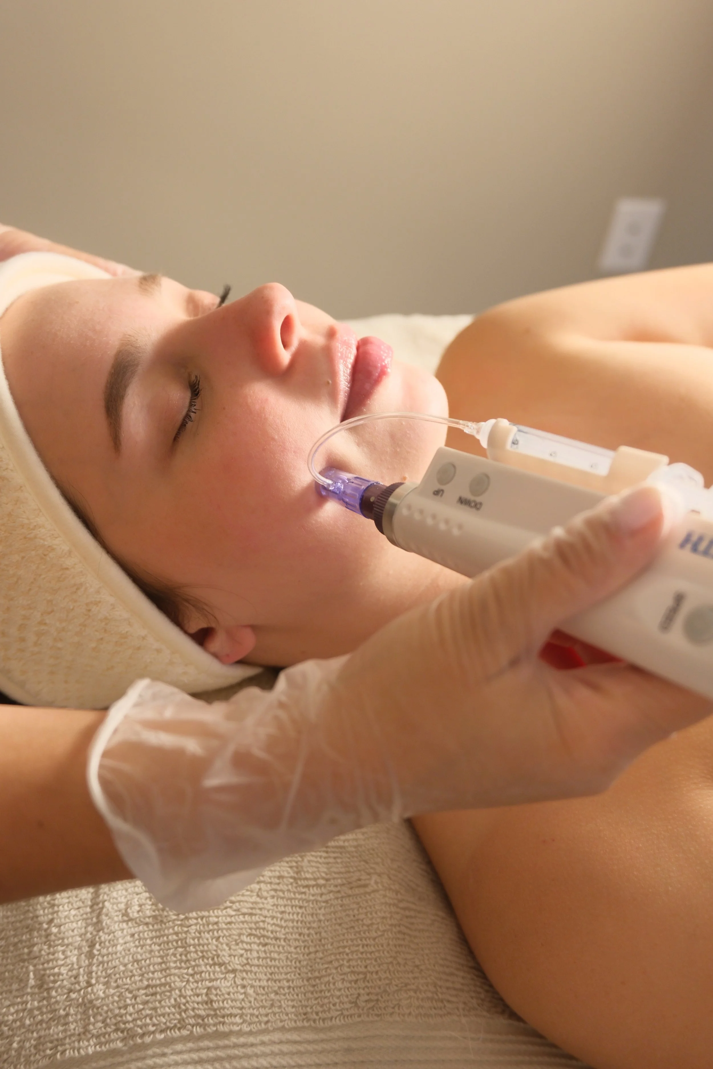 PDRN salmon DNA microneedling for skin repair and radiance in Miami med spa