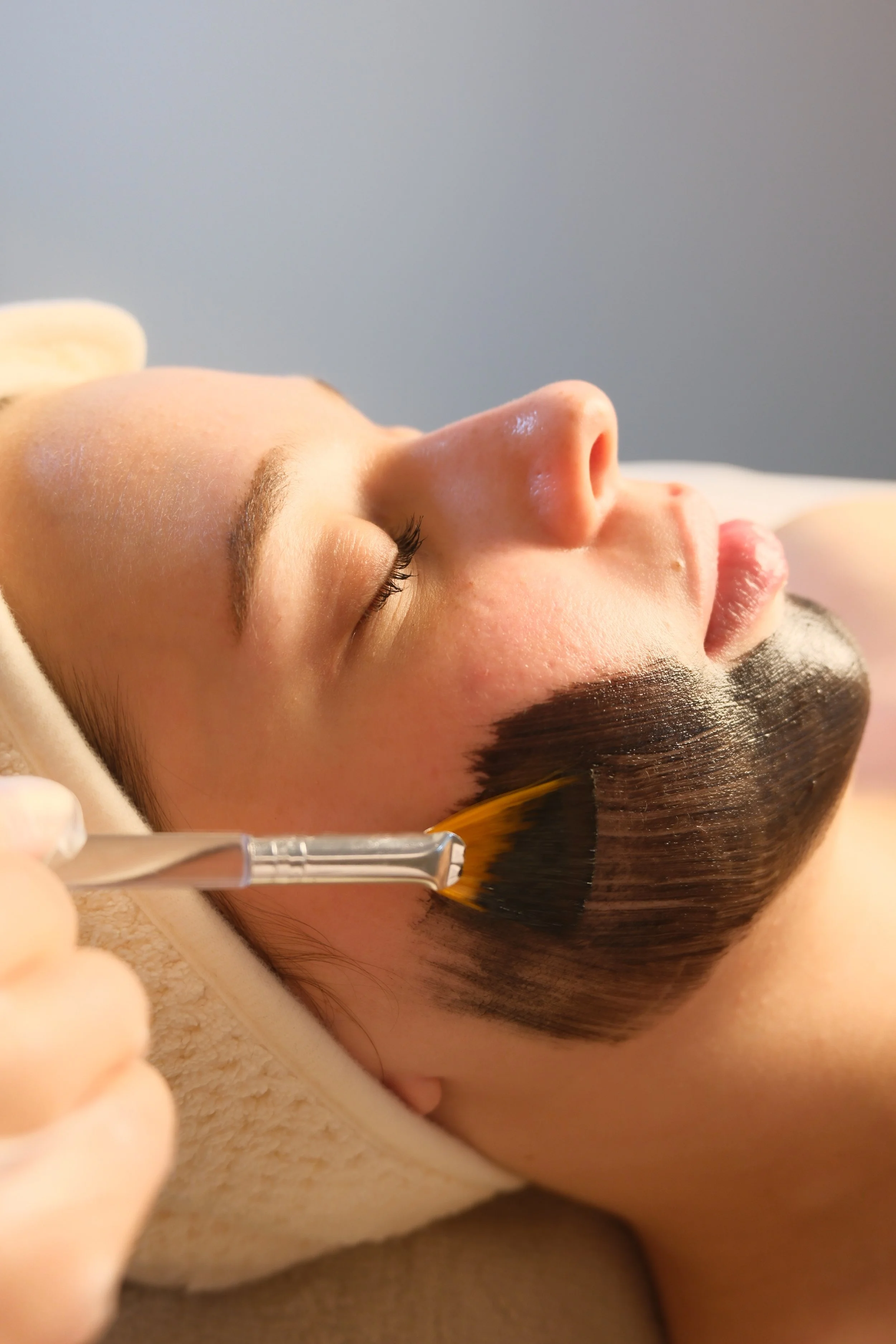 Carbon laser Hollywood peel for bright, refined skin in Miami
