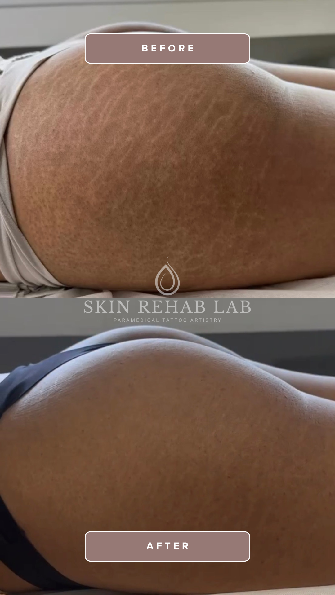 10.png