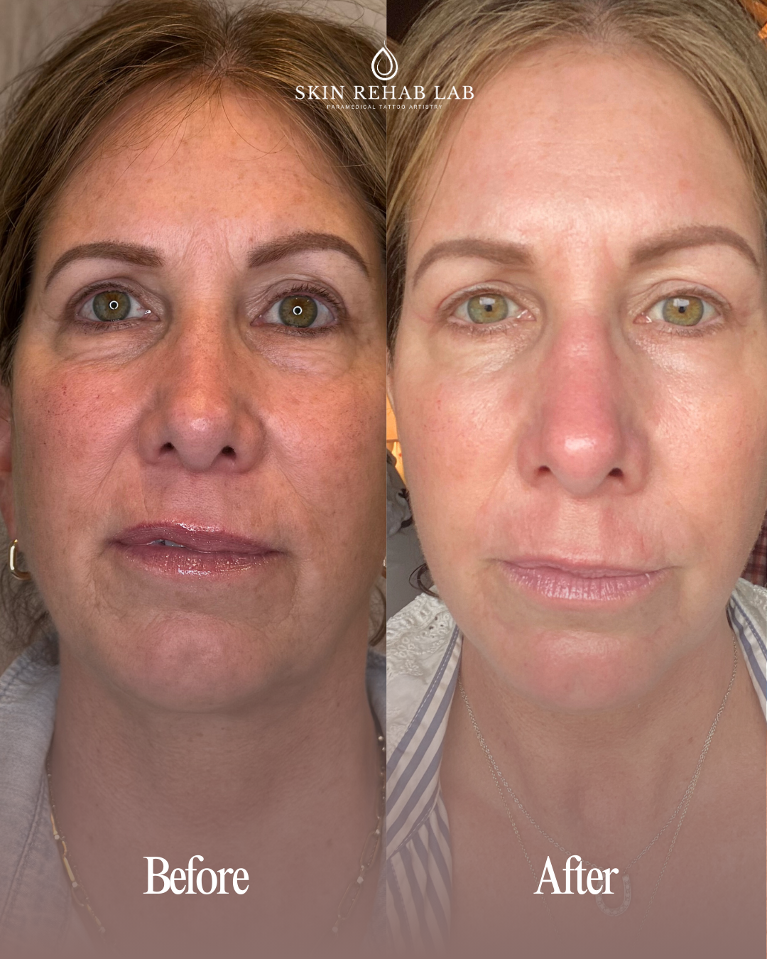 Photo Mar 04 2026, 7 49 27 AM (6).png