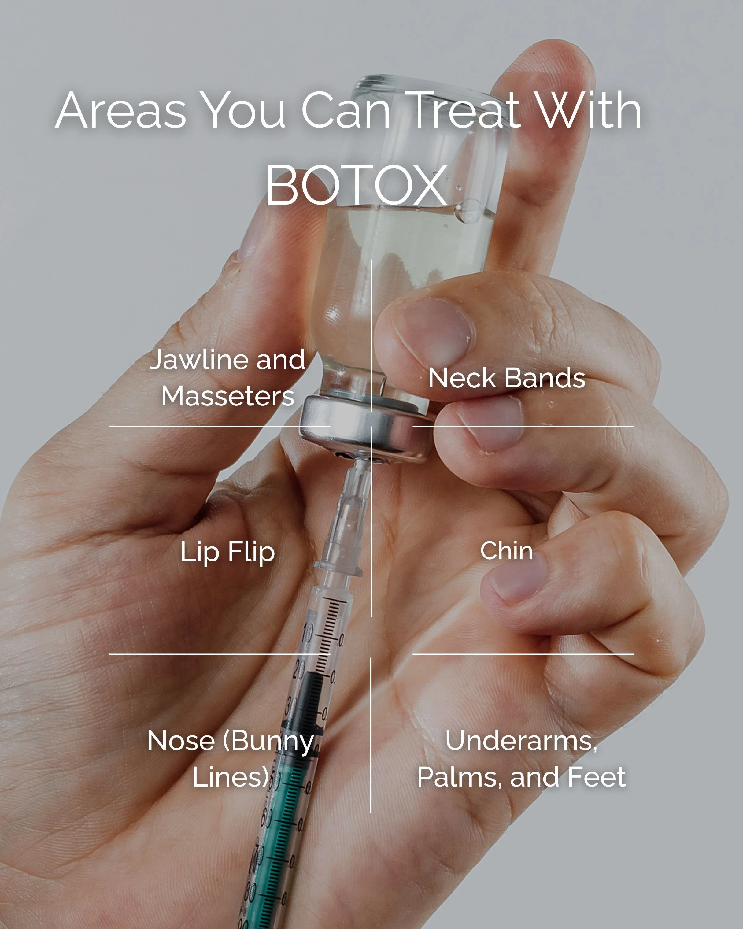 Areas You Can Treat with BOTOX.jpg