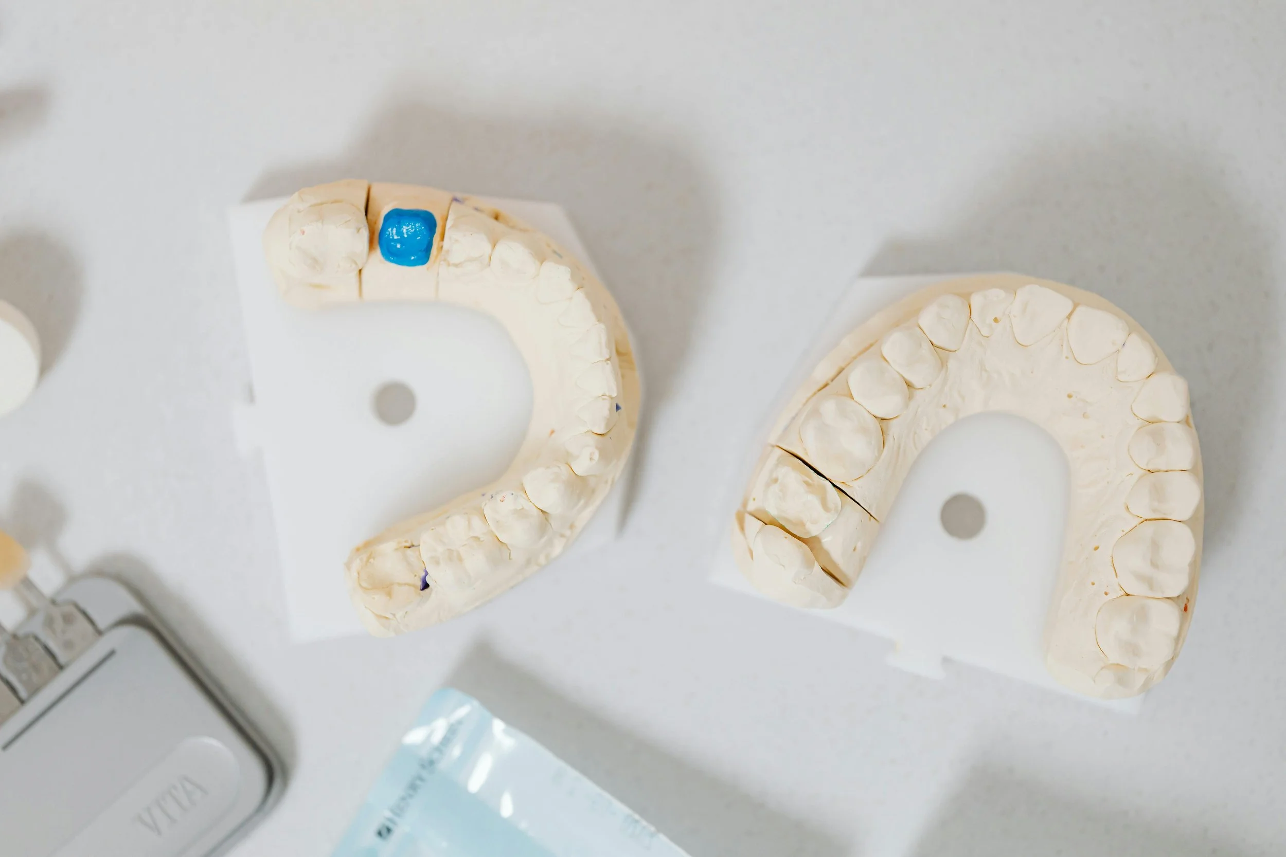 Dental models showing types of restorative work