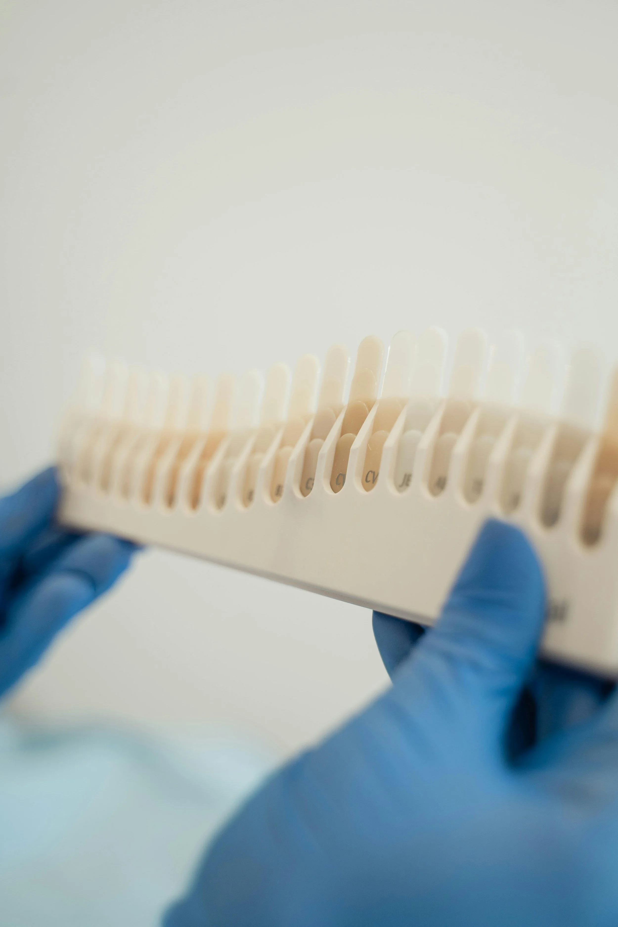 Close-up of dental professional using tooth colour shade chart