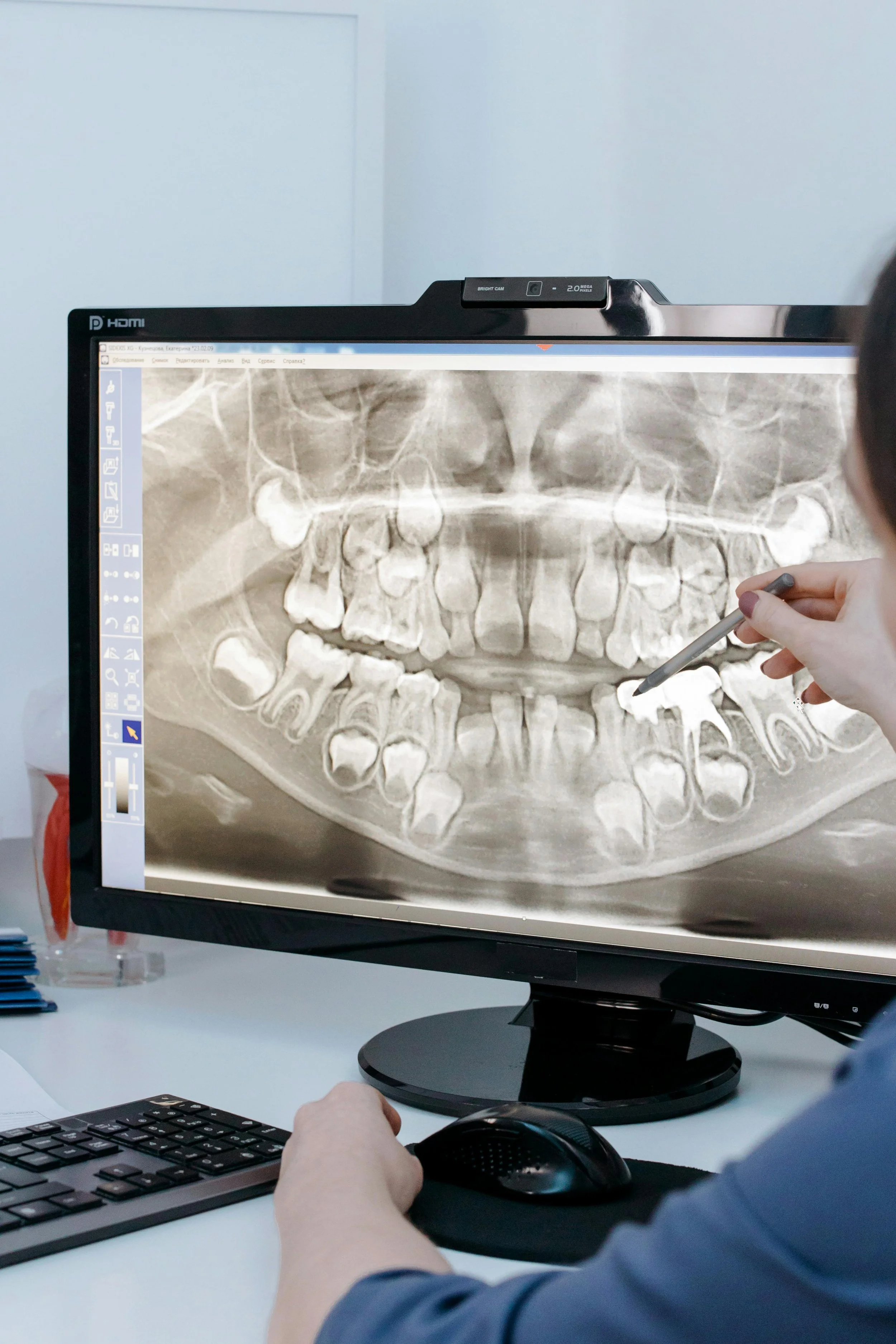 Person pointing to an area of a dental xray using a pen
