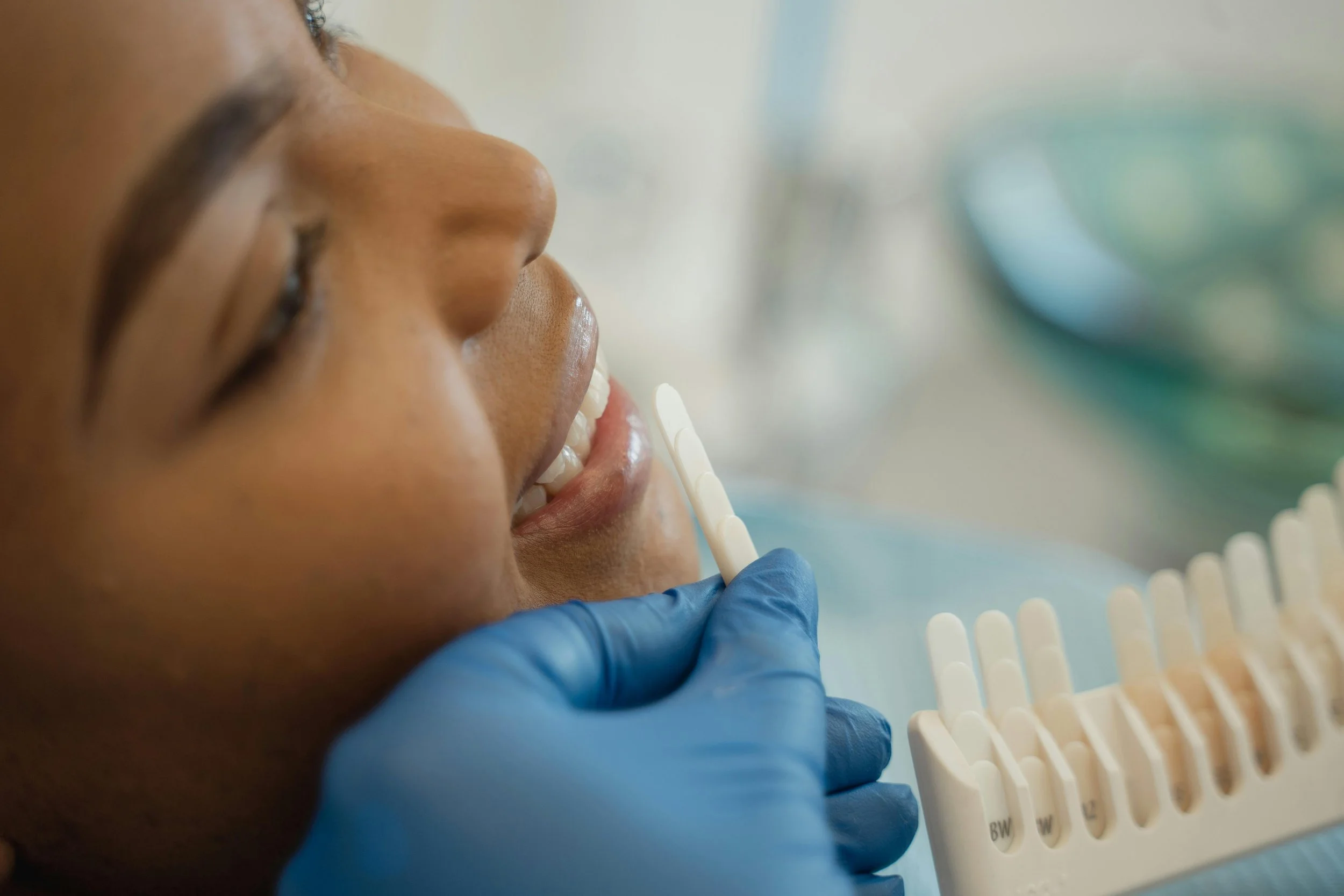 A gloved hand holding a tooth colour chart next to a smiling mouth