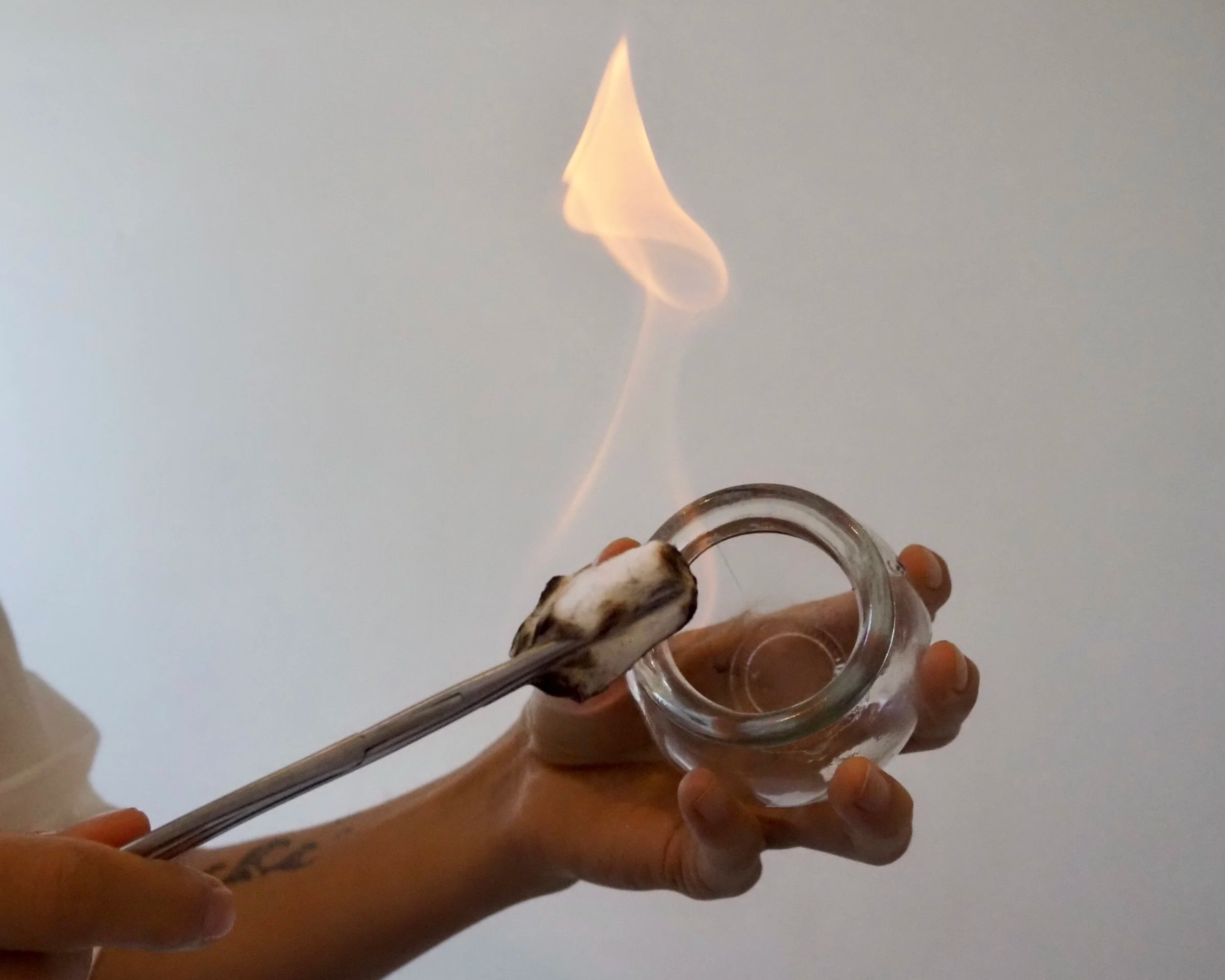 Cupping for athletes in Kew, Melbourne. Cupping therapy for pain relief in Kew, Melbourne. Sport injuries and recovery.