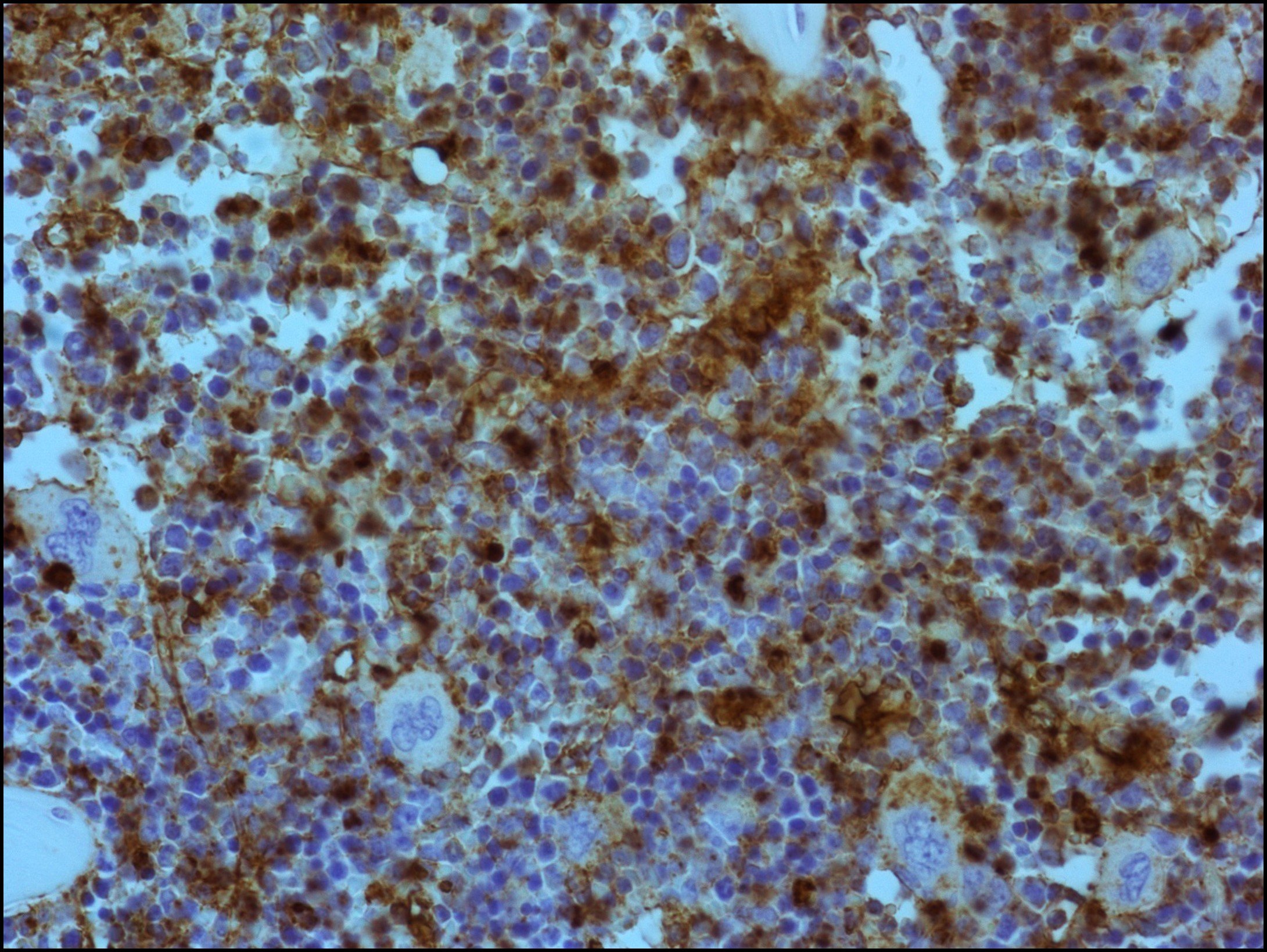 HA BM Staining.jpg