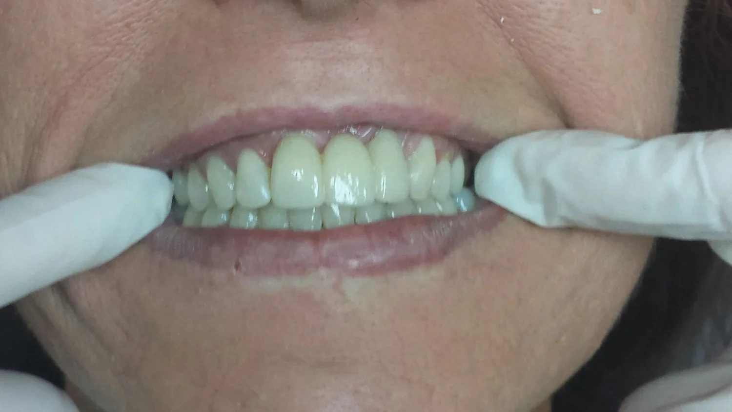 AFTER - Brianne (Copy) (Copy)